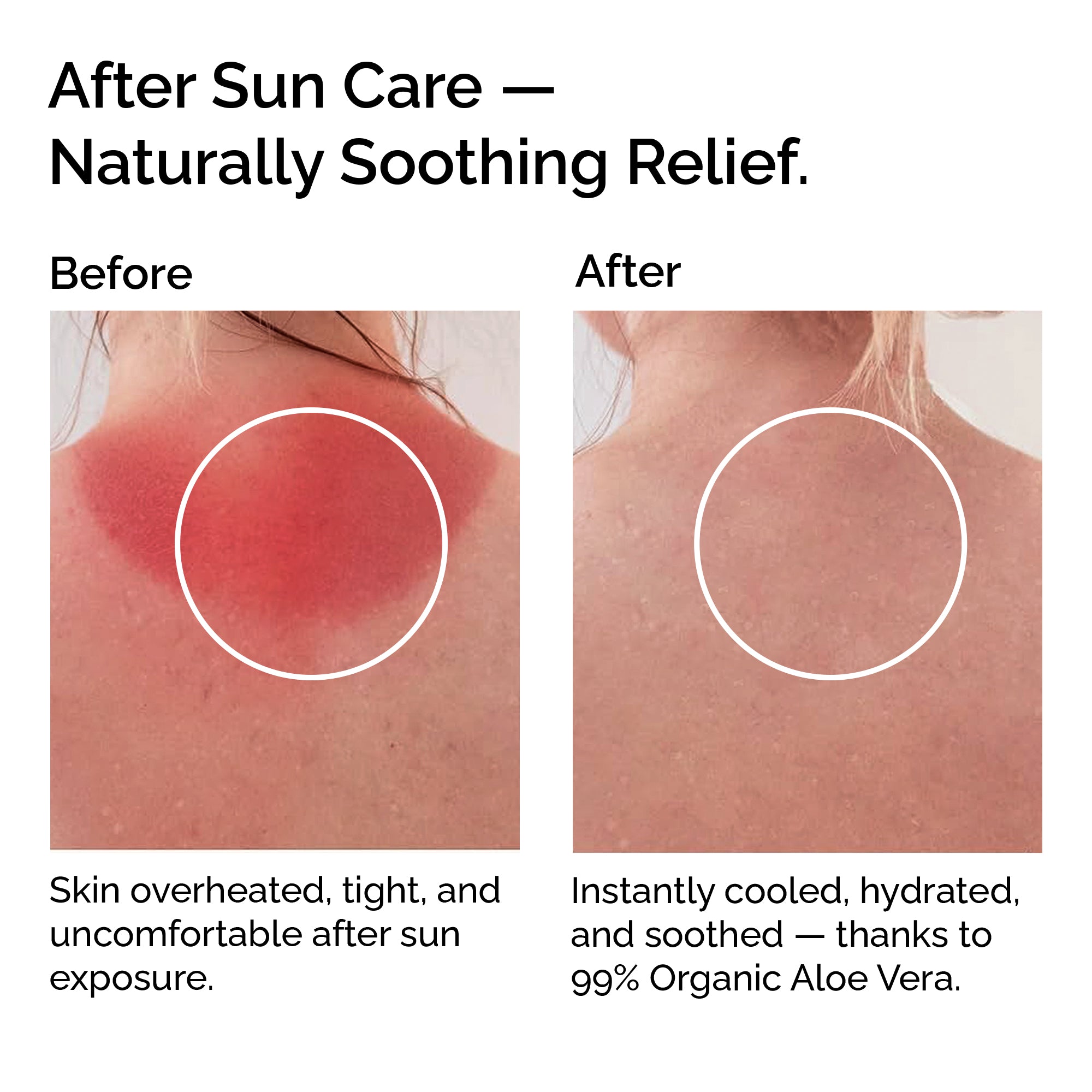 Organic Cooling Aloe Vera Gel – Hydrating & Soothing After-Sun Care