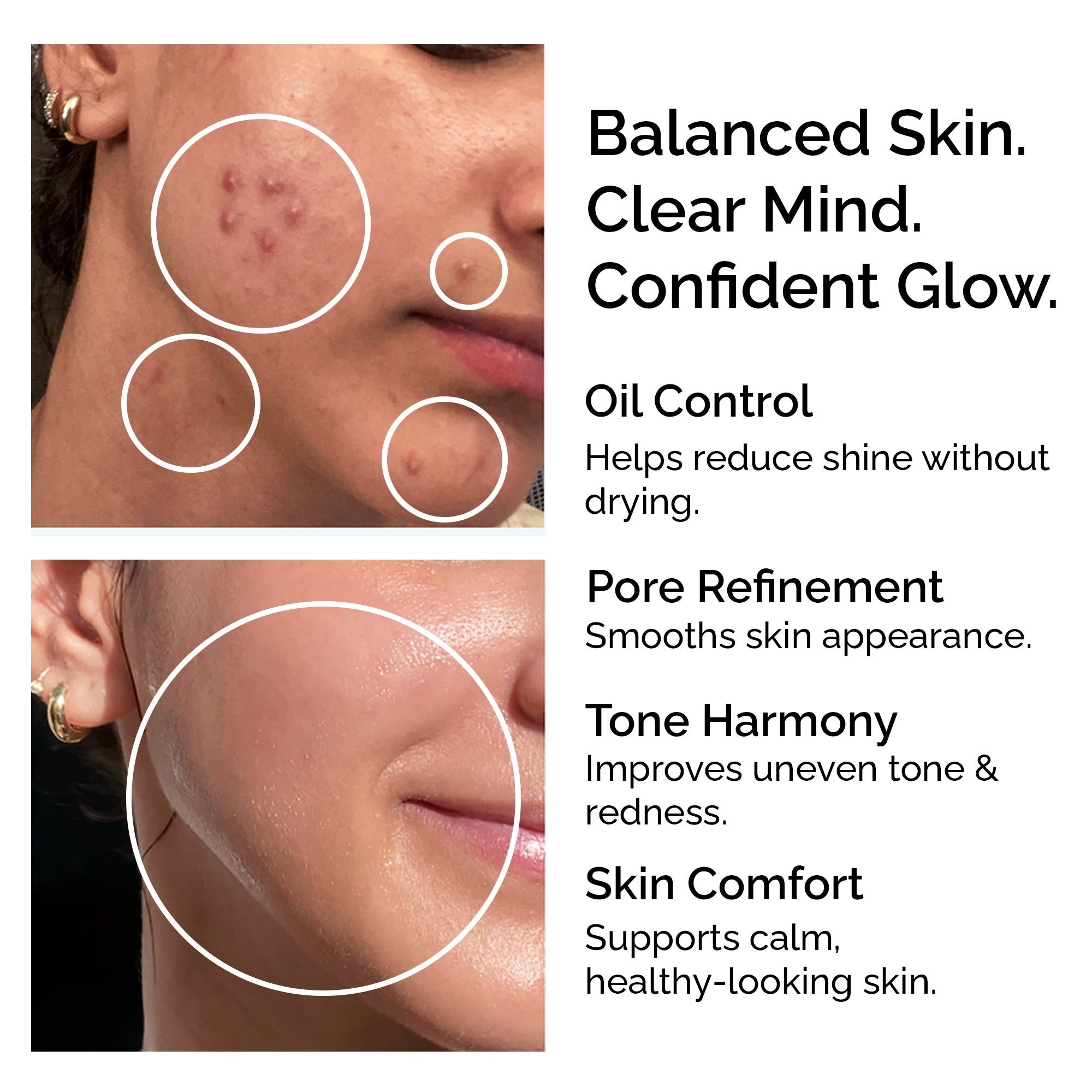 Niacinamide Powder 30g – Pure & Natural Vitamin B3 for Skin Glow, Brightening, Even Skin Tone & Pore Refining Care