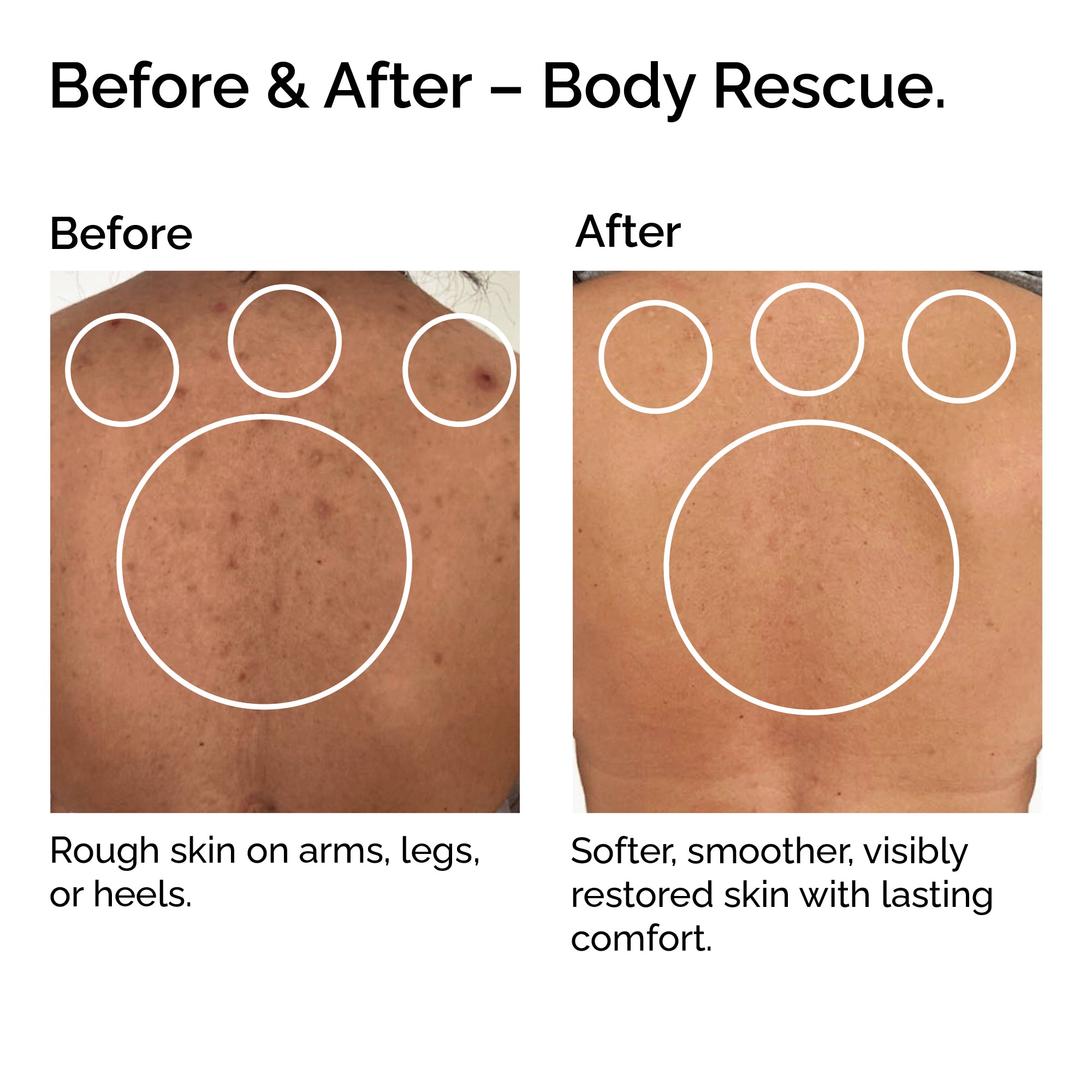 Before and after comparison of skin treatment with &