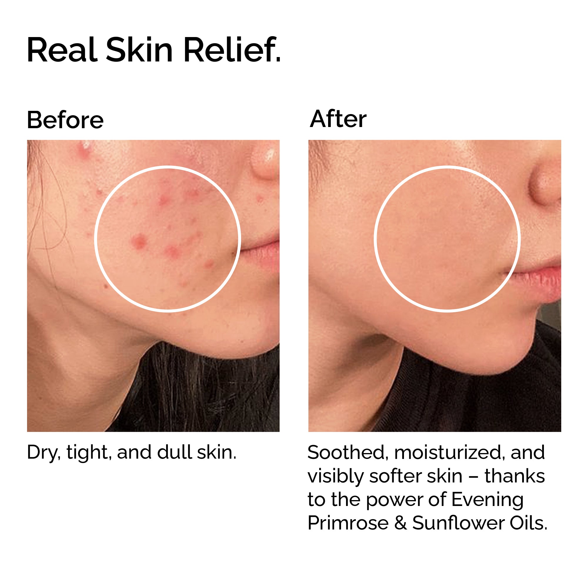 Organic Moisturizing Day Cream – Hydrates & Soothes Skin Naturally