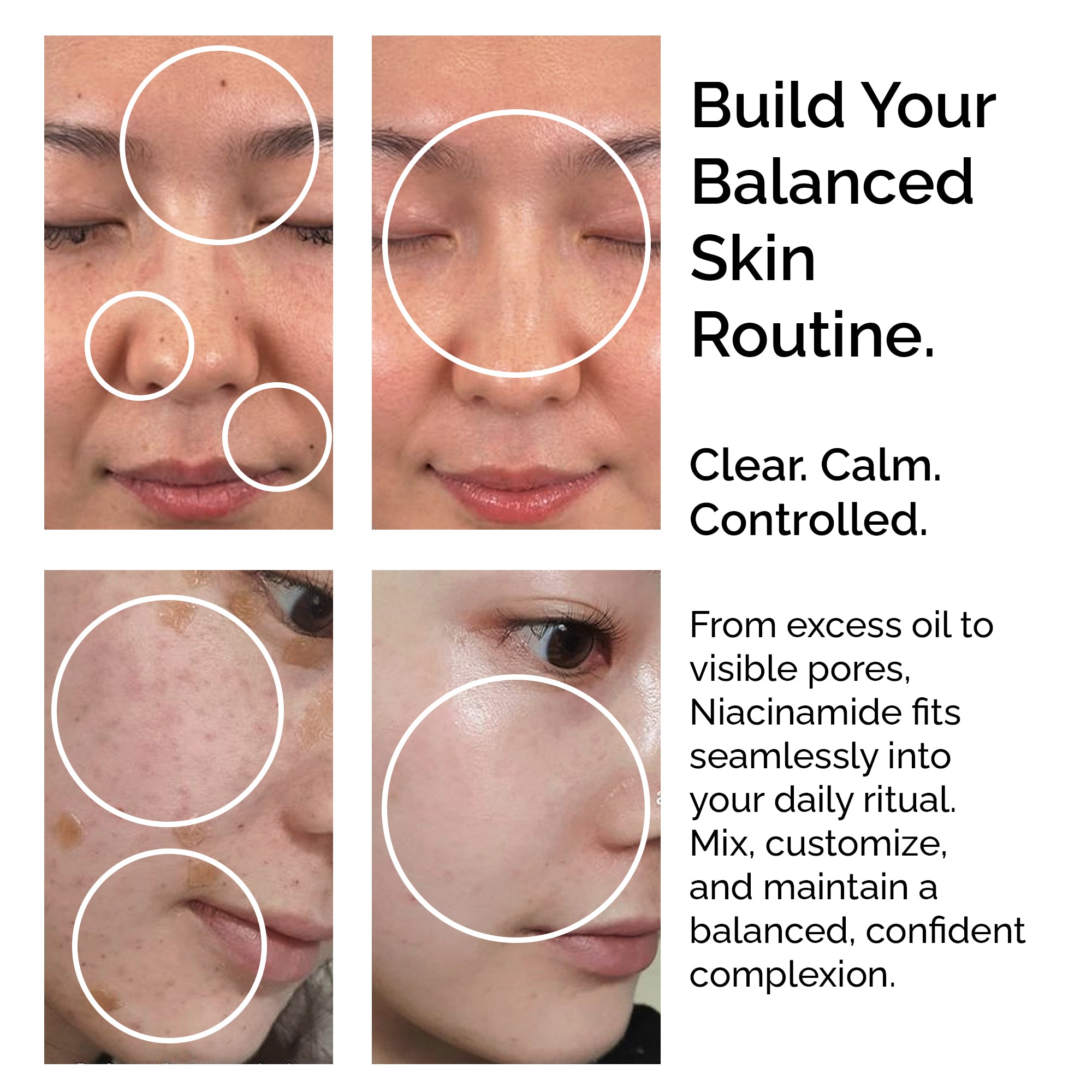 Niacinamide Powder 30g – Pure & Natural Vitamin B3 for Skin Glow, Brightening, Even Skin Tone & Pore Refining Care