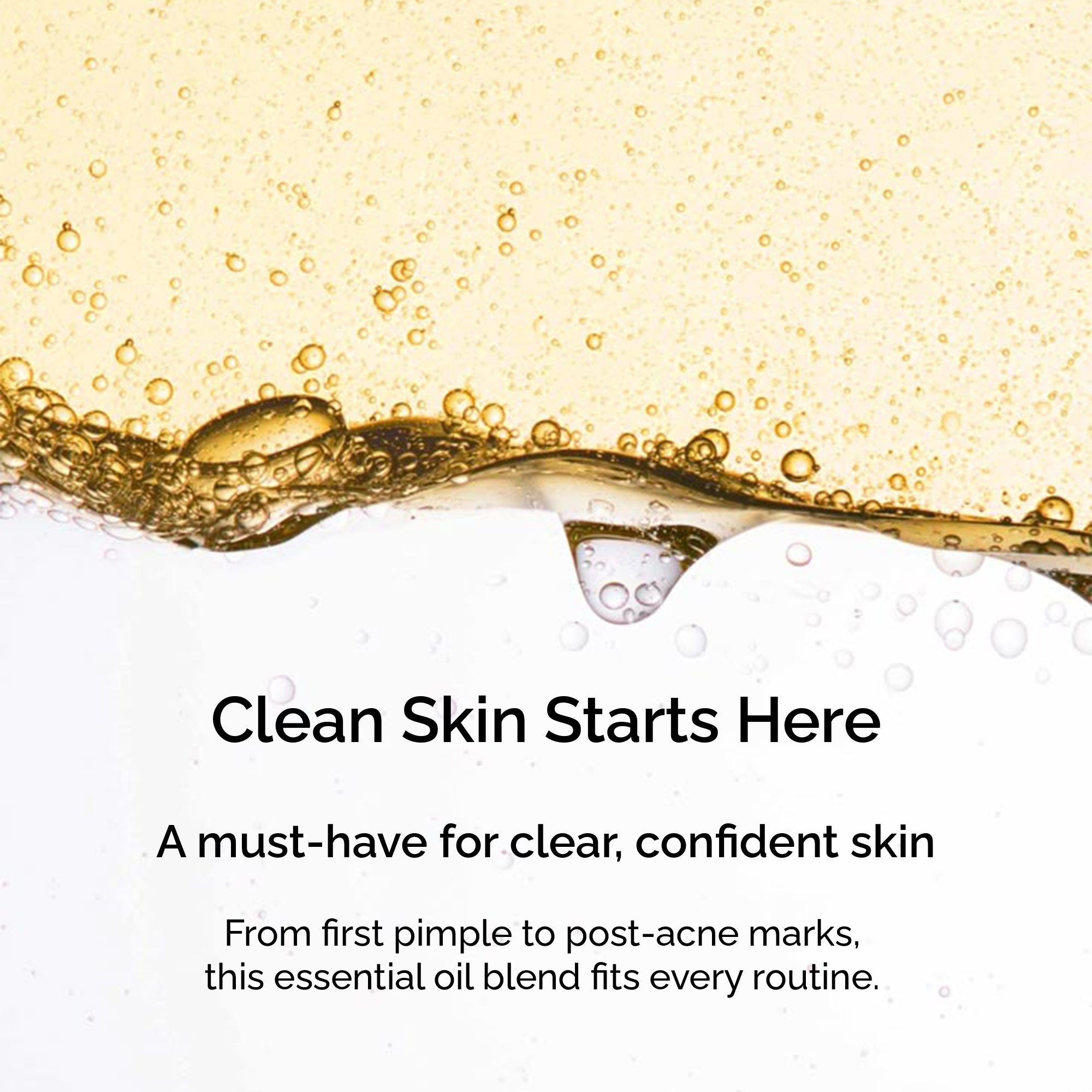 Clear Skin Blend – Essential Oils for Acne, Blemishes & Blackheads