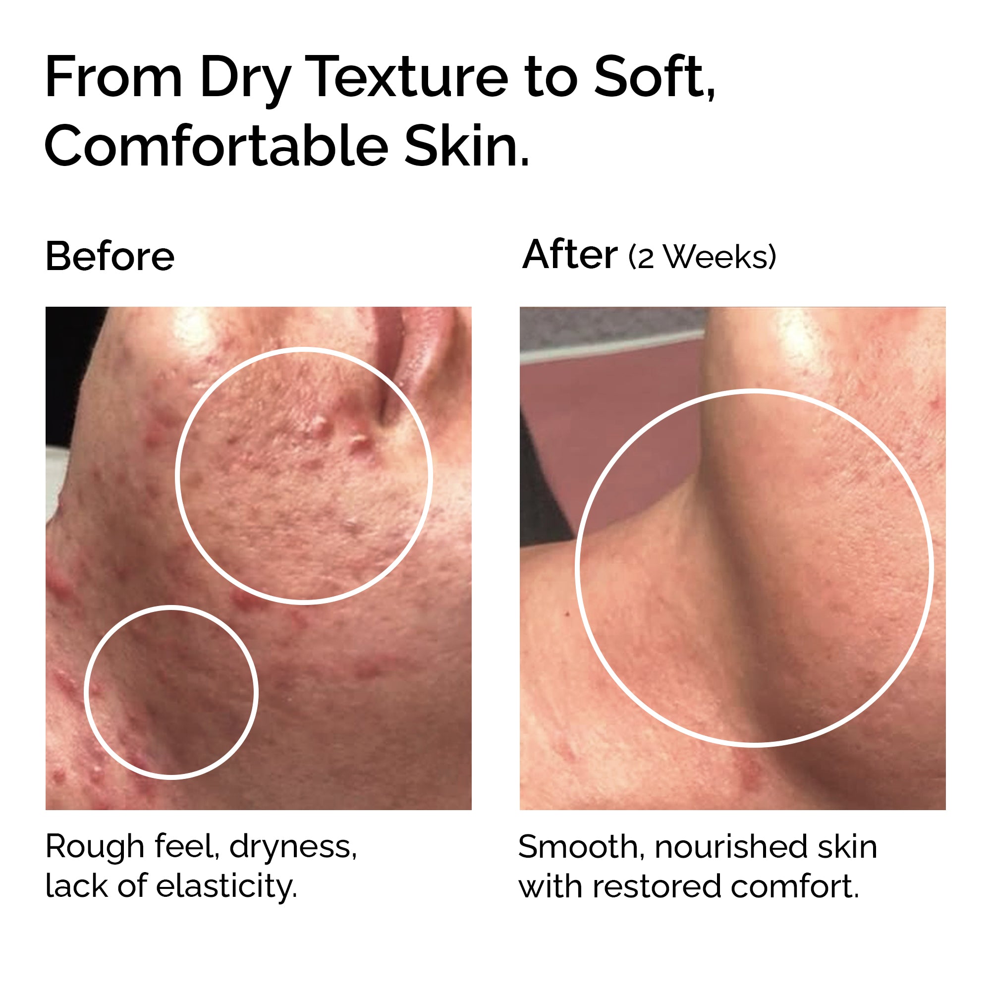 Calendula Infused Oil – Face, Body & Baby Care for Sensitive Skin