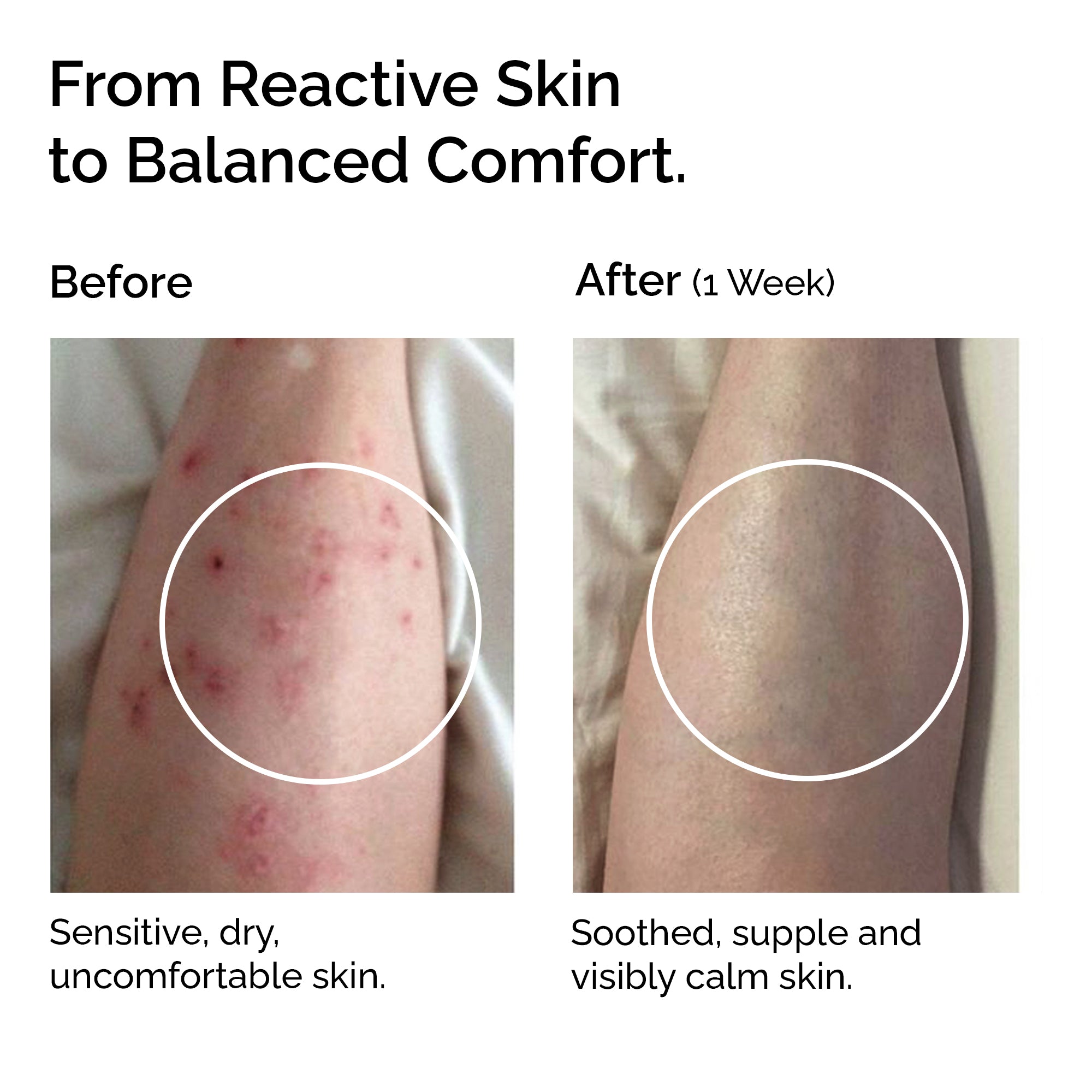 Calendula Infused Oil – Face, Body & Baby Care for Sensitive Skin