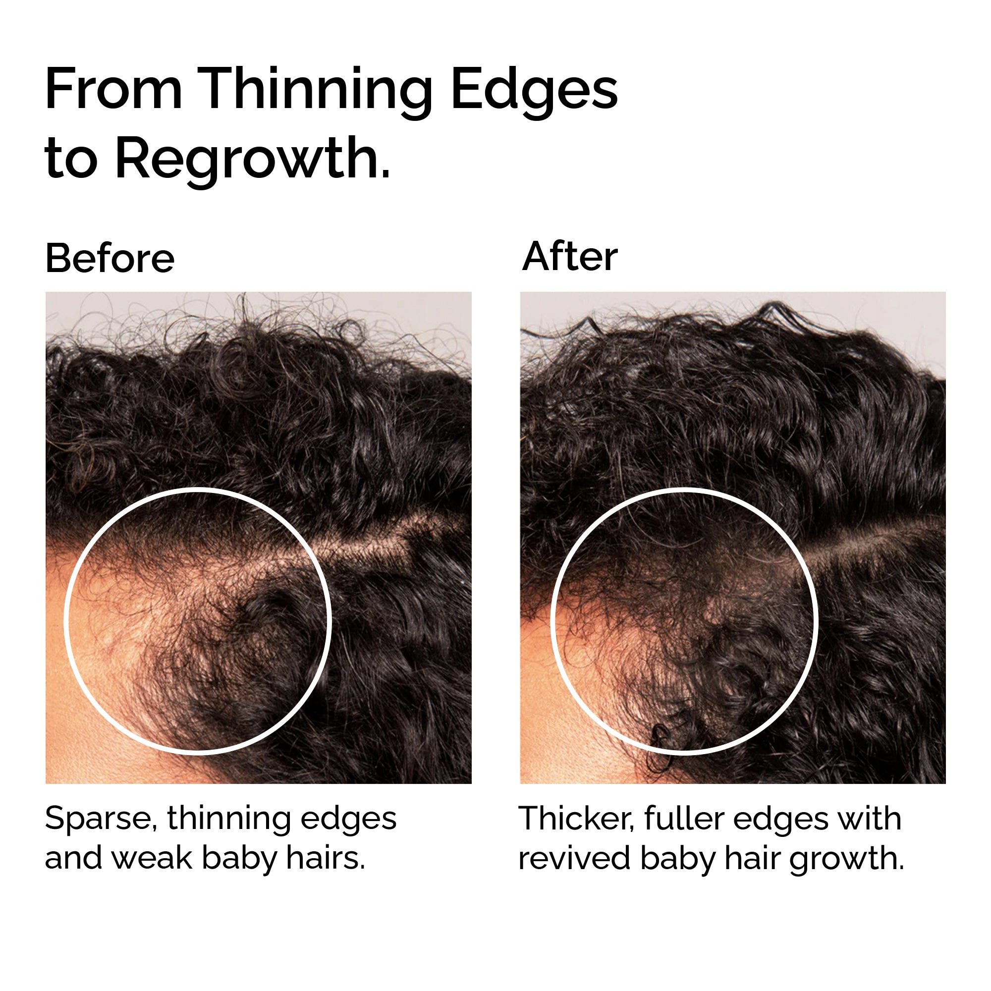 Organic Hair Growth Oil Serum – Strengthening & Nourishing Hair Treatment