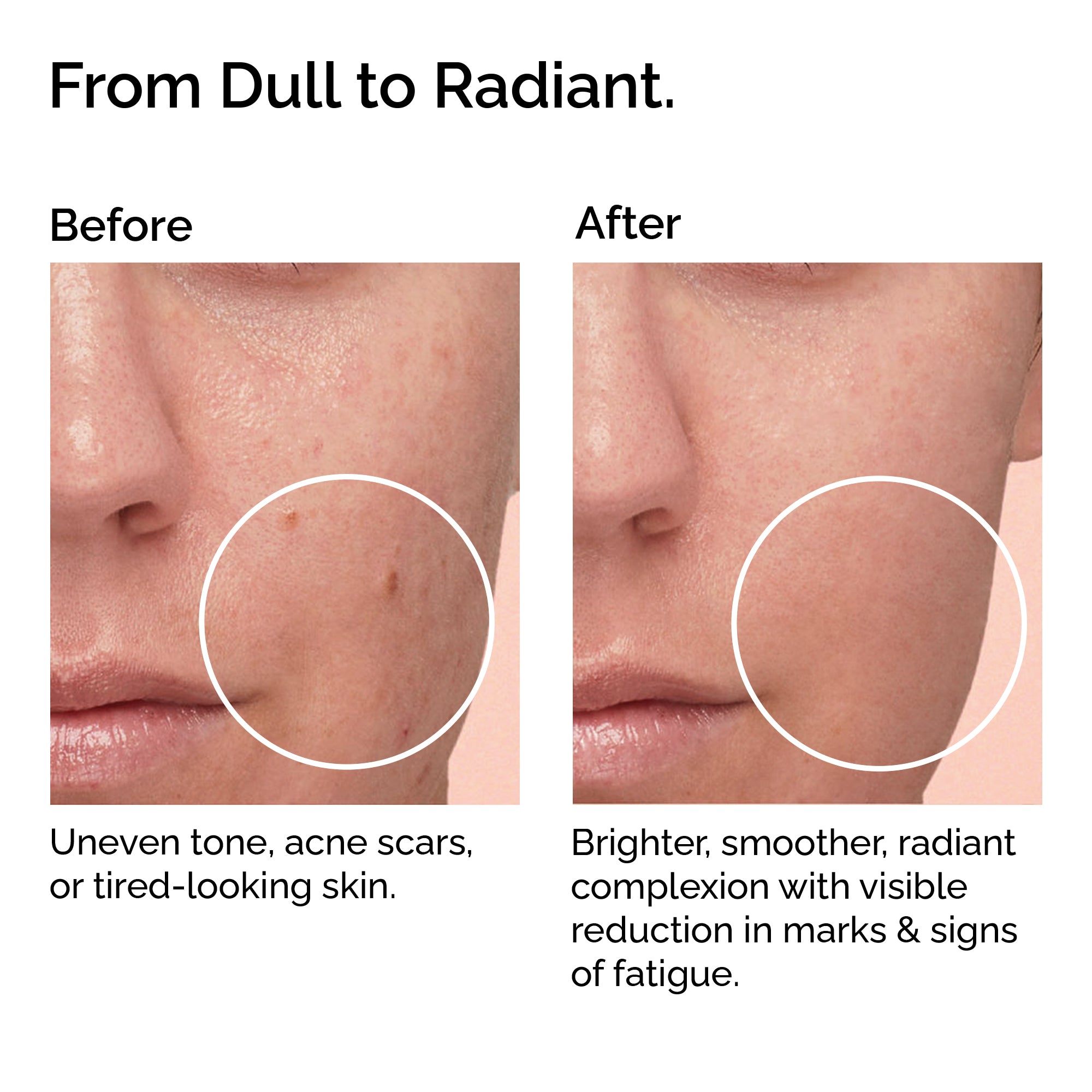Rosehip Oil – 100% Organic, Cold-Pressed & Pure – Hydrating, Anti-Aging & Scar Care – Fast-Absorbing.