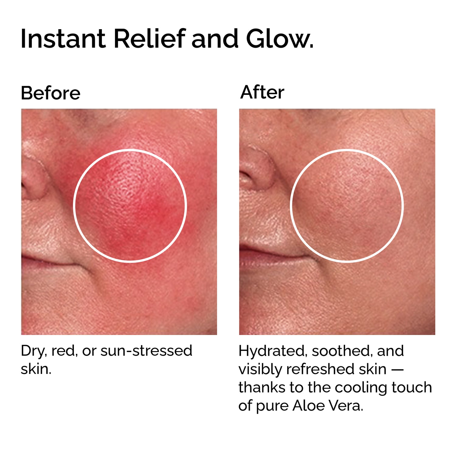 Organic Cooling Aloe Vera Gel – Hydrating & Soothing After-Sun Care