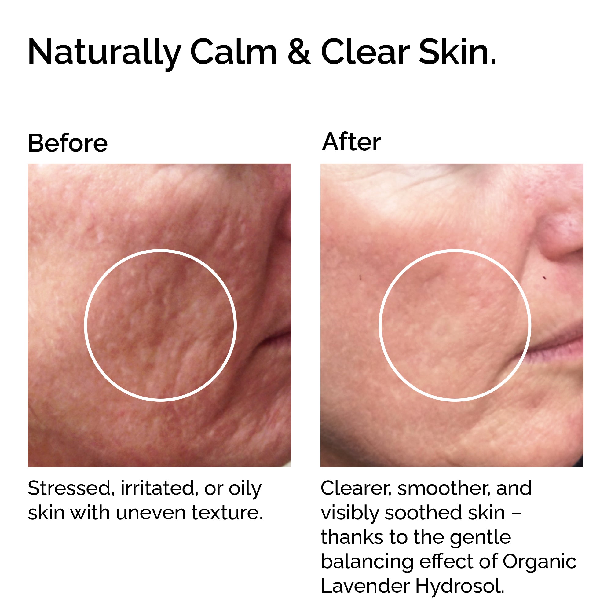 Organic Lavender Hydrosol – Soothing Floral Water for Skin & Hair