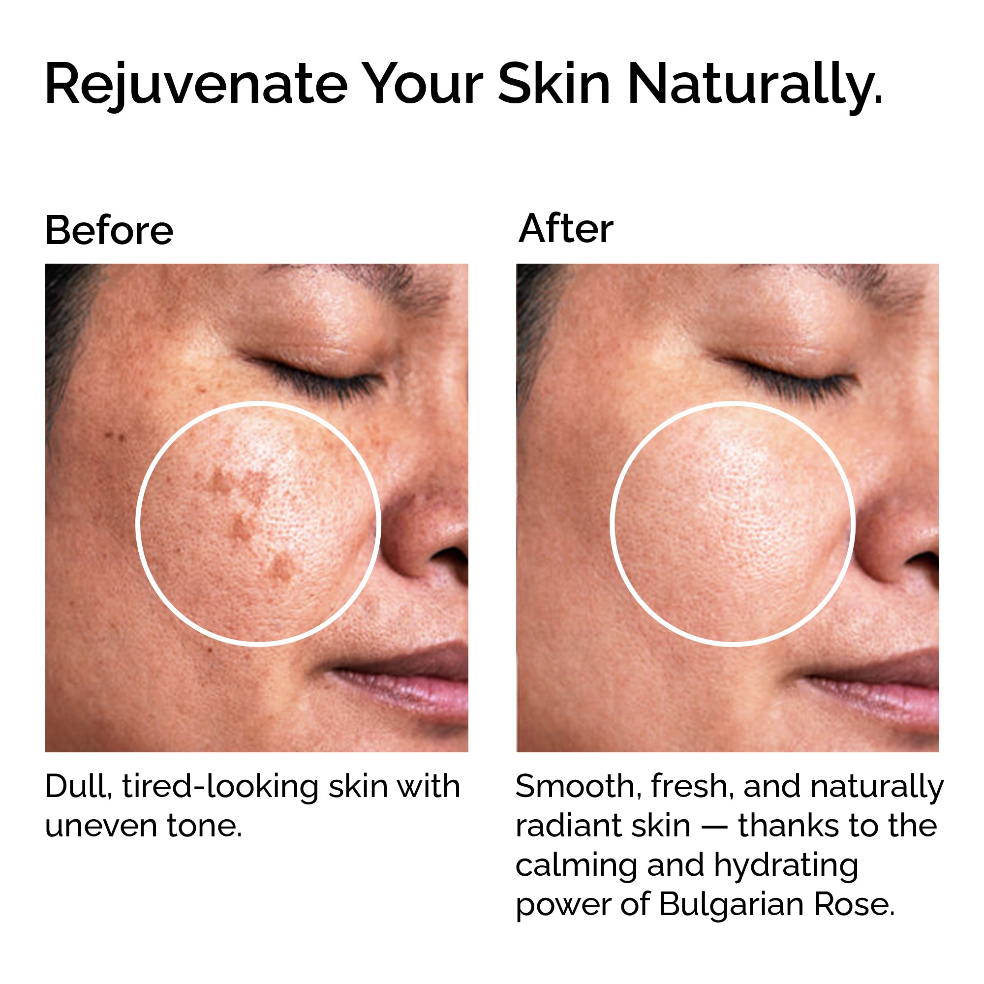 Organic Rose Water from Bulgaria – Natural Hydrosol Floral for Skin & Hair Care