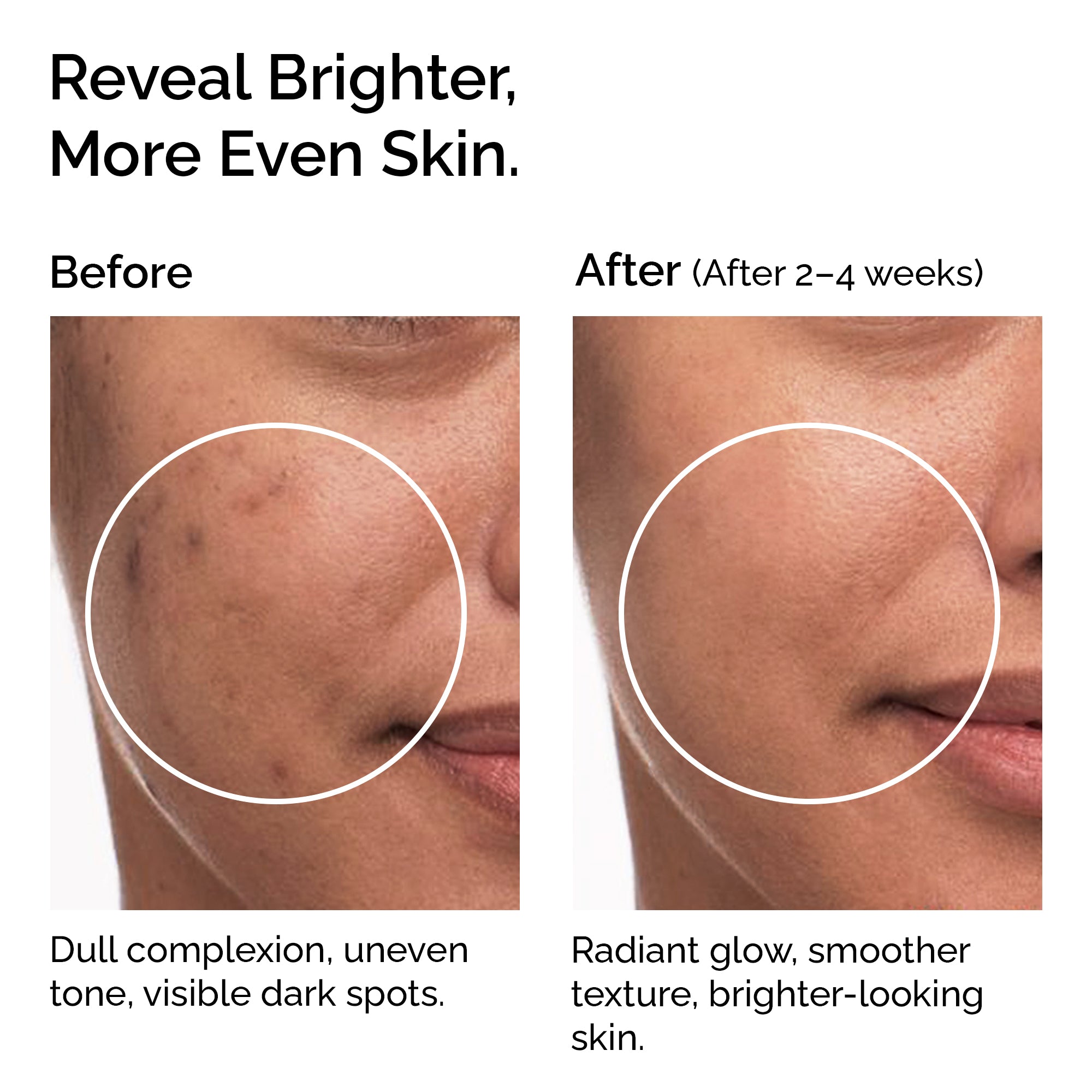 Pure L-Ascorbic Acid (Vitamin C) Powder 30g – For Face, Skin, Body & Hair Brightening Care