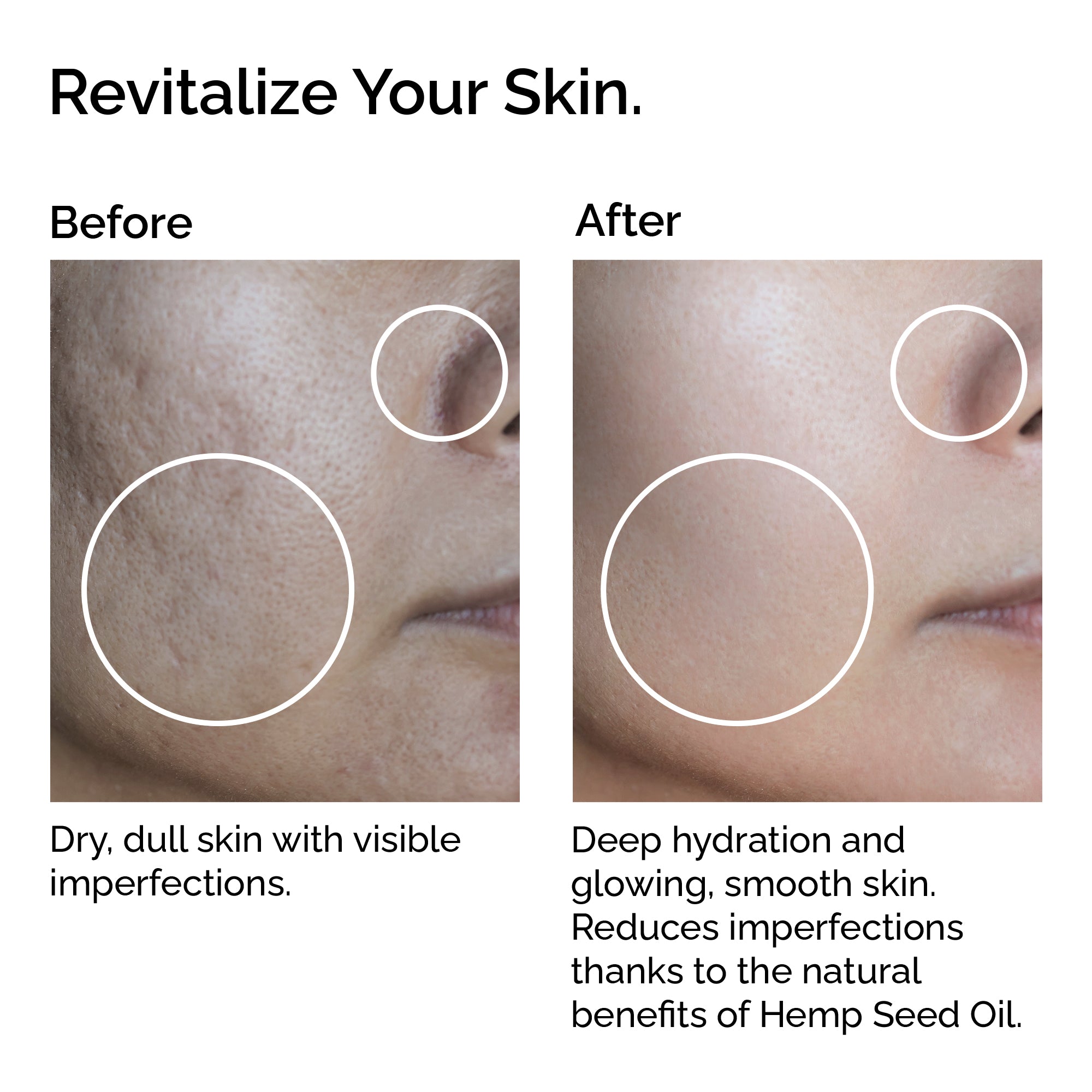 Huile de graines de chanvre – Huile biologique 100 % pure pour le soin de la peau et des cheveux