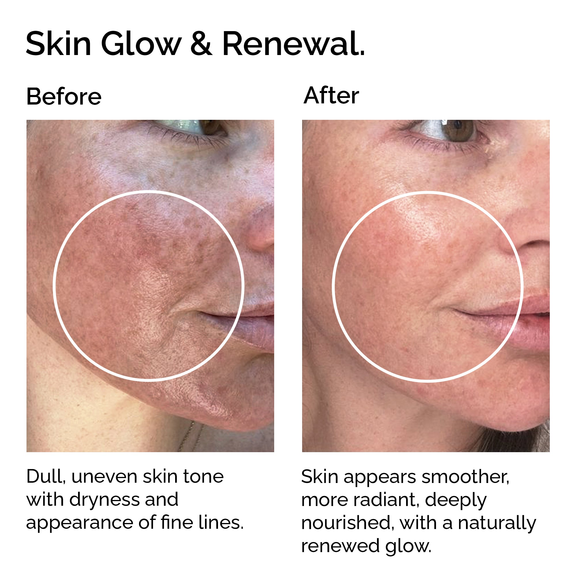 Organic Castor Oil – 100% Pure, Cold-Pressed for Hair, Skin & Lashes