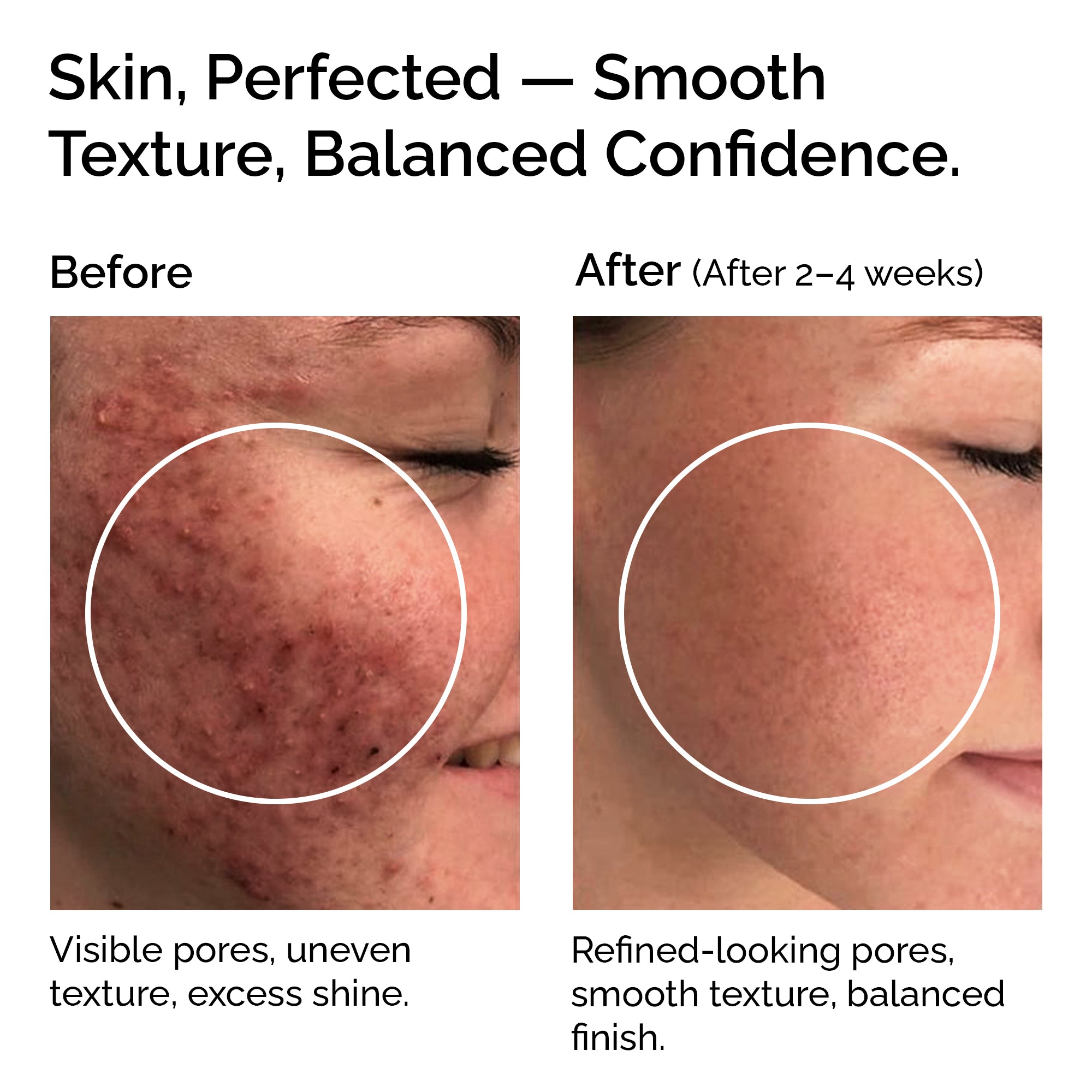 Niacinamide Powder 30g – Pure & Natural Vitamin B3 for Skin Glow, Brightening, Even Skin Tone & Pore Refining Care