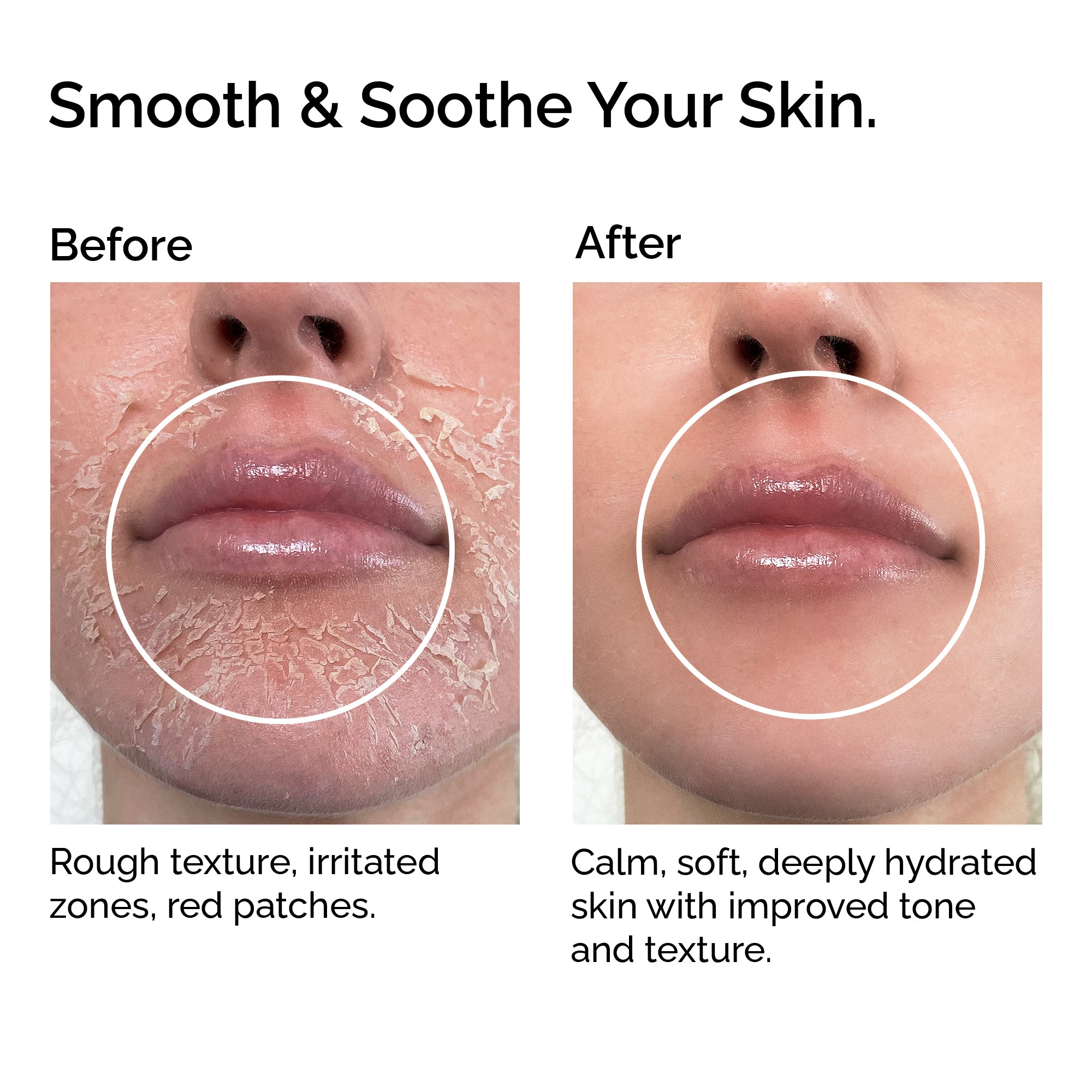 Rosehip Oil – 100% Organic, Cold-Pressed & Pure – Hydrating, Anti-Aging & Scar Care – Fast-Absorbing.