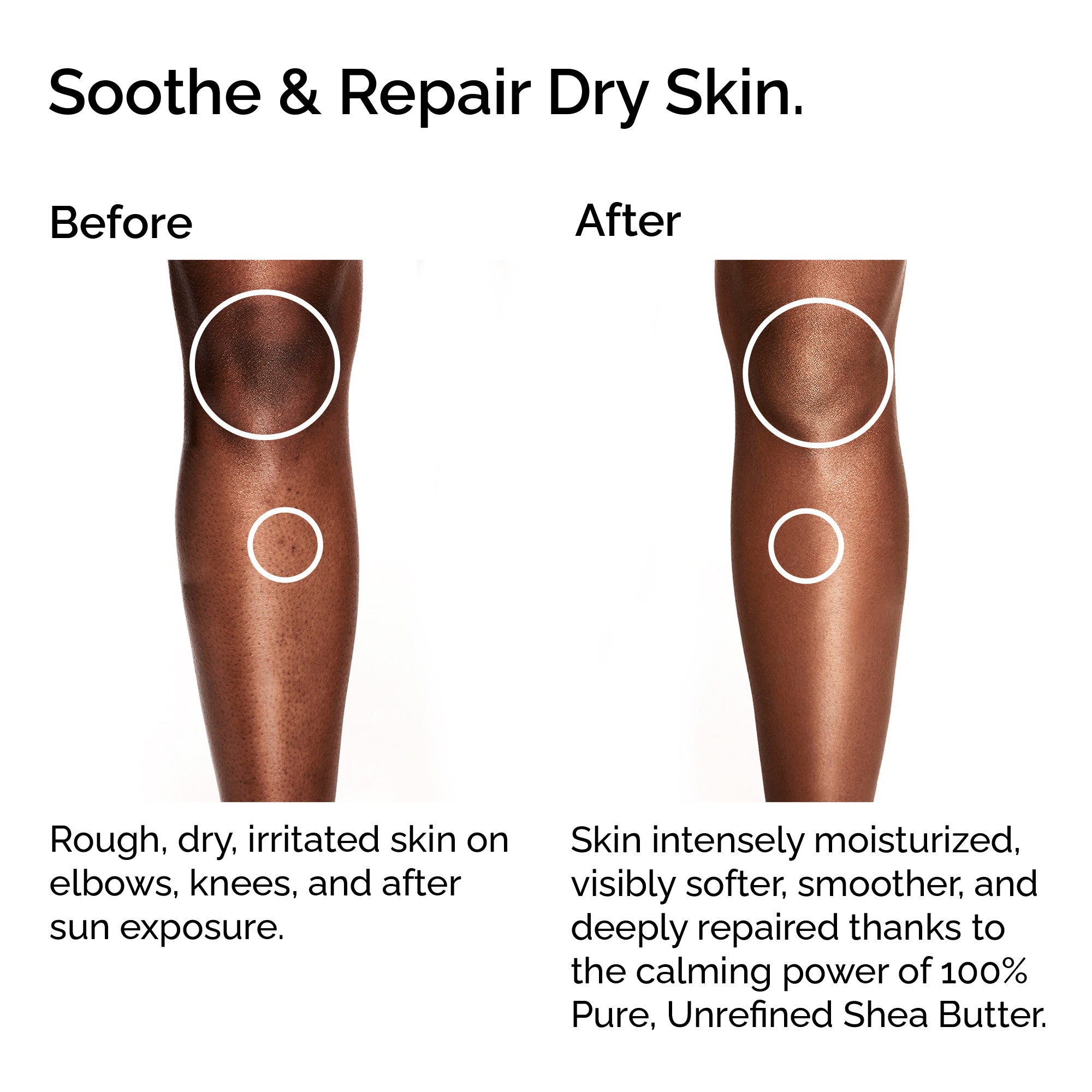 100% Organic Raw & Unrefined Shea Butter – Pure & Natural