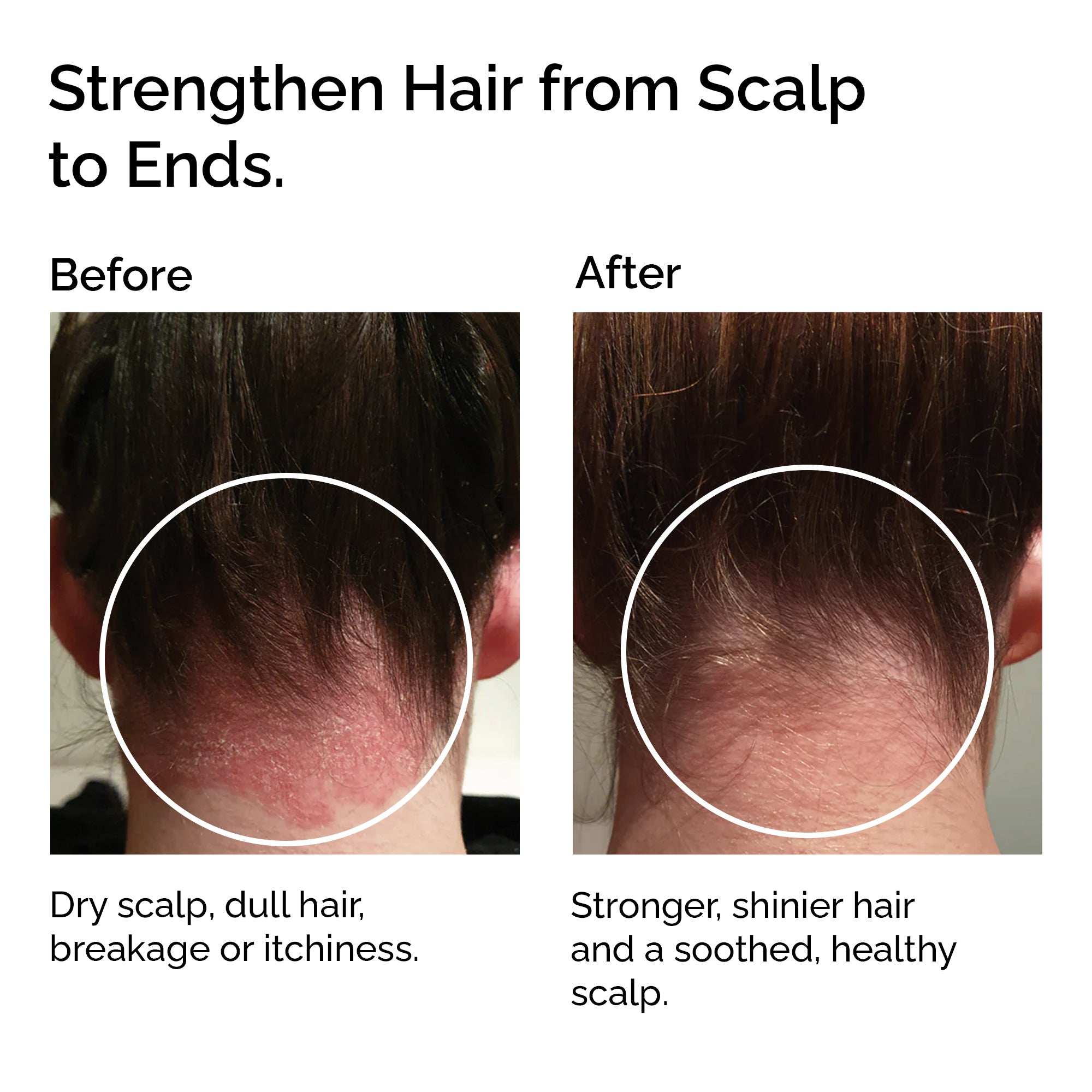 Organic Jojoba Oil – 100% Pure, For Face, Body & Hair Care