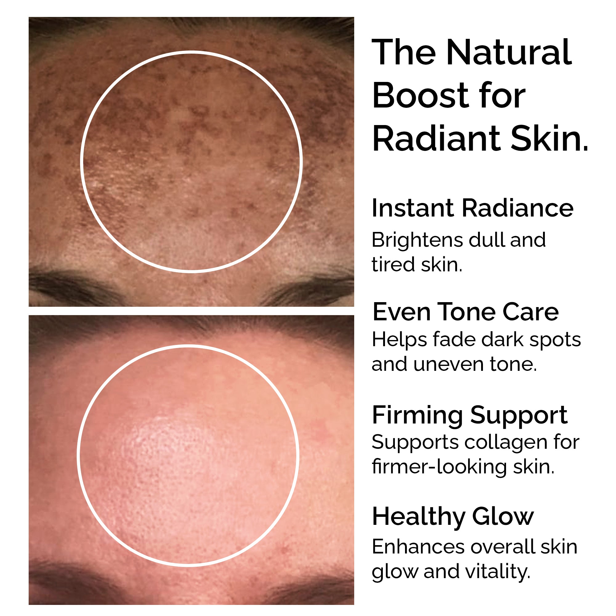 Pure L-Ascorbic Acid (Vitamin C) Powder 30g – For Face, Skin, Body & Hair Brightening Care