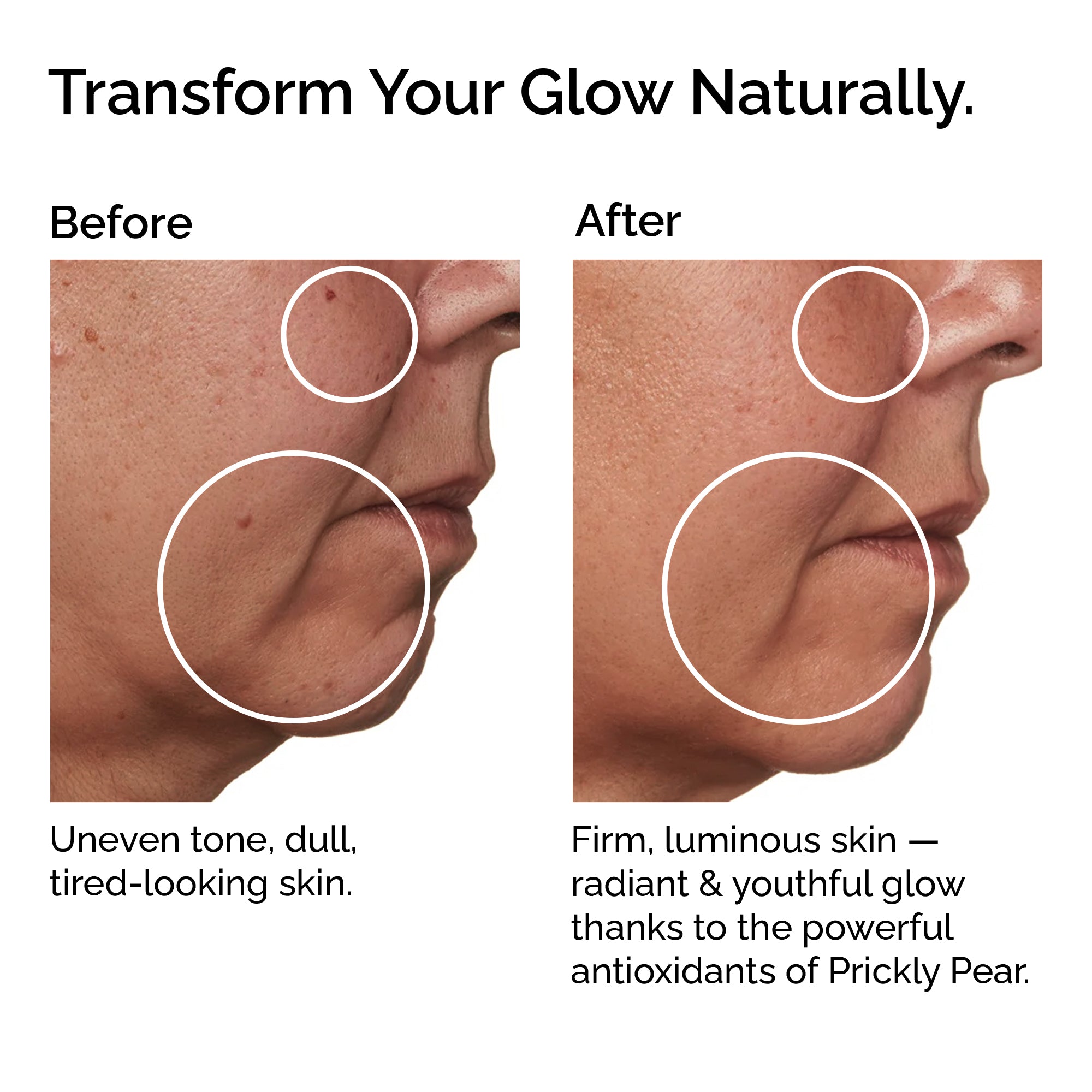 Organic Prickly Pear Seed Oil (Opuntia stricta) – Pure, Cold-Pressed – Anti-Aging & Nourishing Facial Oil