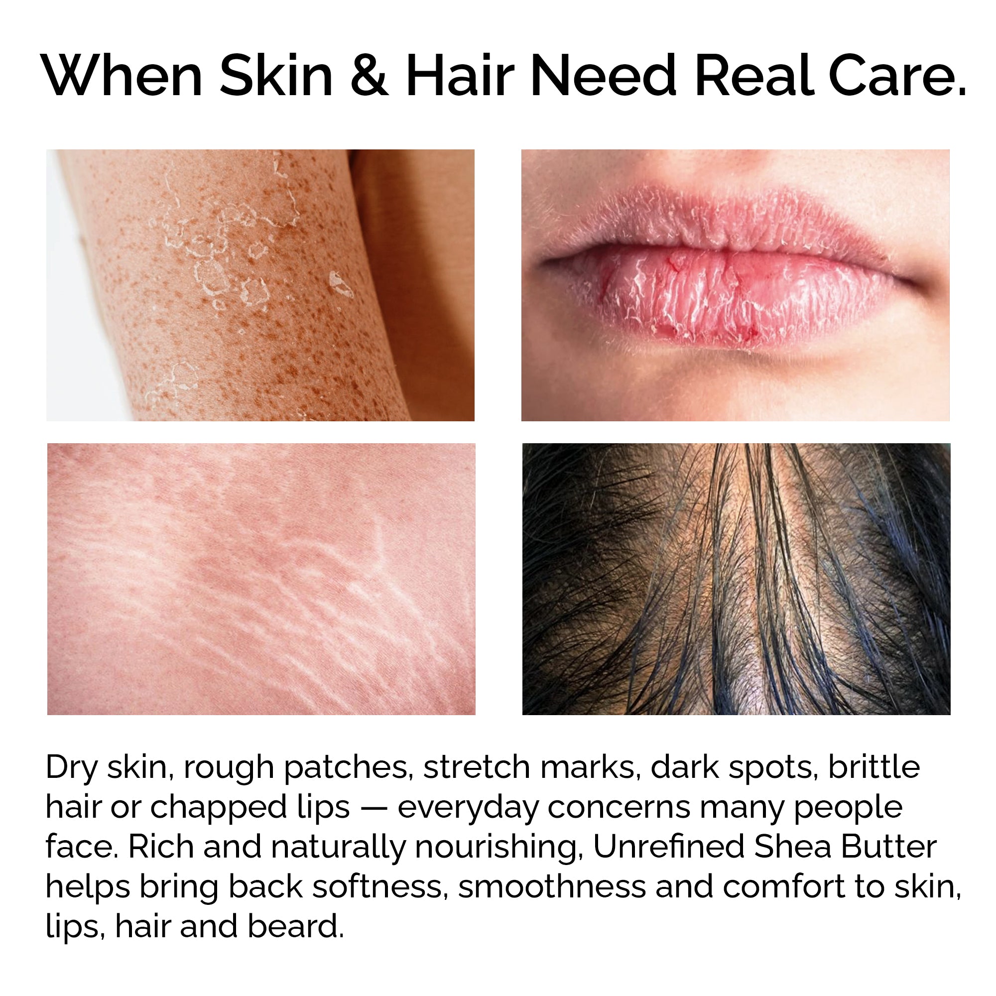 Raw Shea Butter – 100% Pure Organic, Hair & Skin