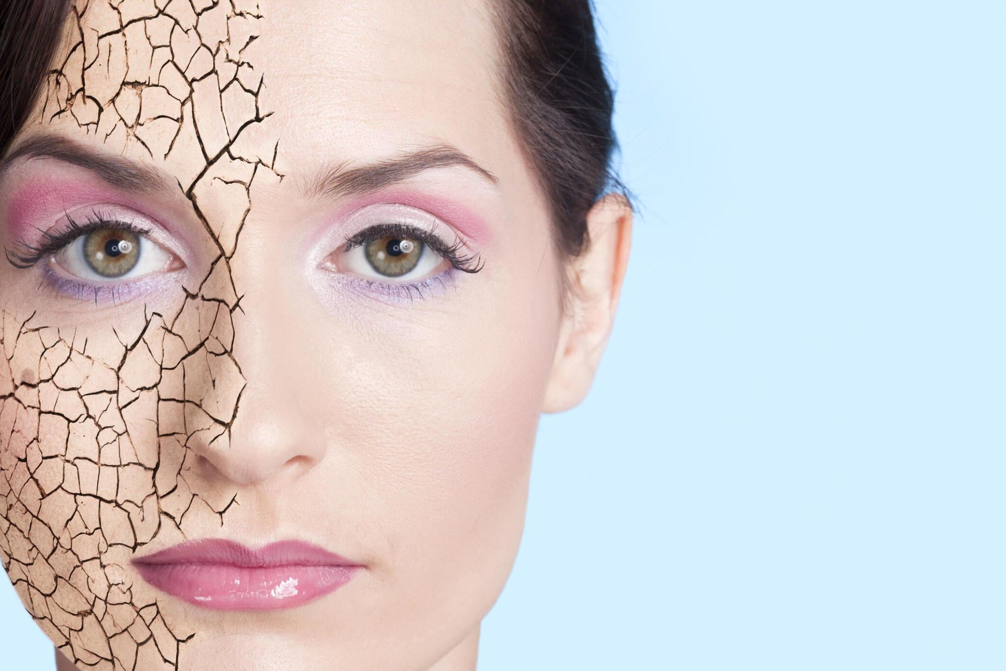 Image by gettyimages.ae, Excagurated dry skin effect on one half of the face of a beautiful woman.