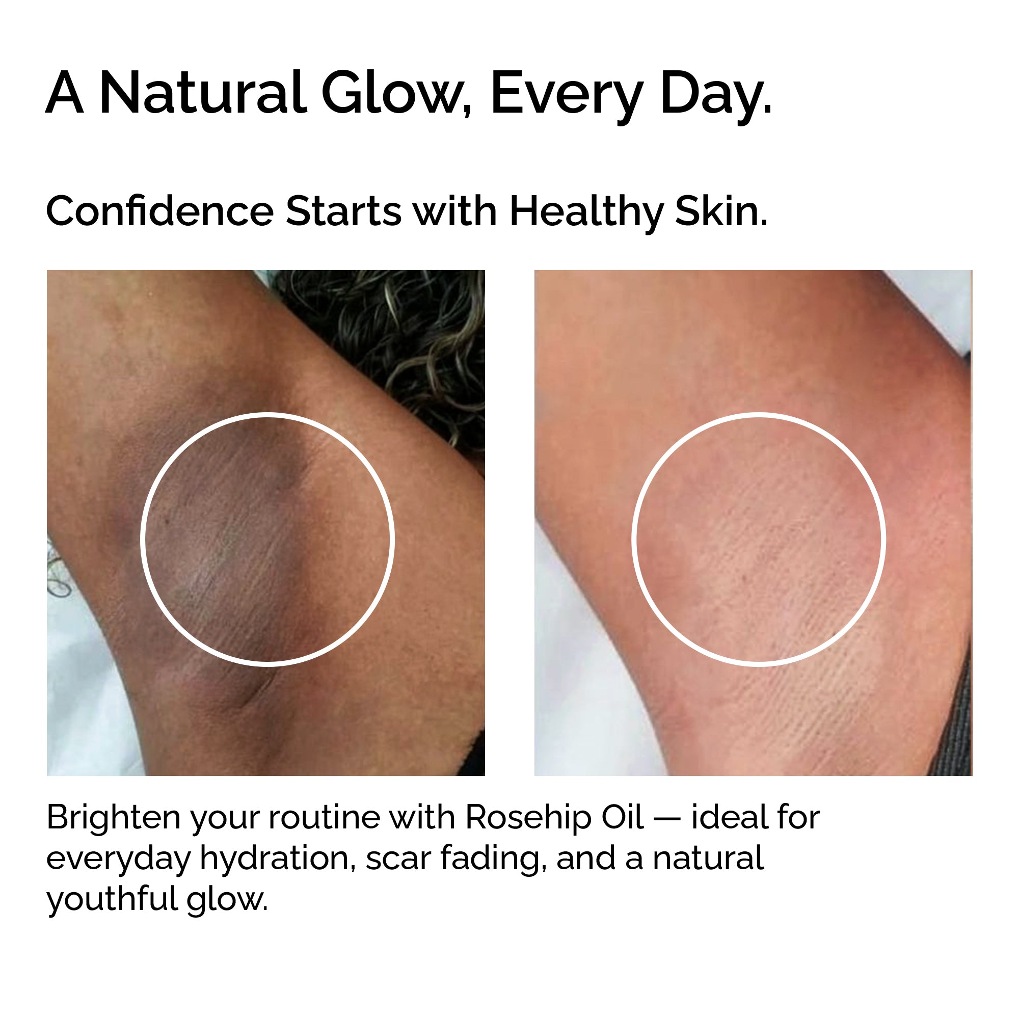 Organic Rosehip Oil – 100% Pure Cold-Pressed Plant-Based Oil for Face, Body &amp; Hair
