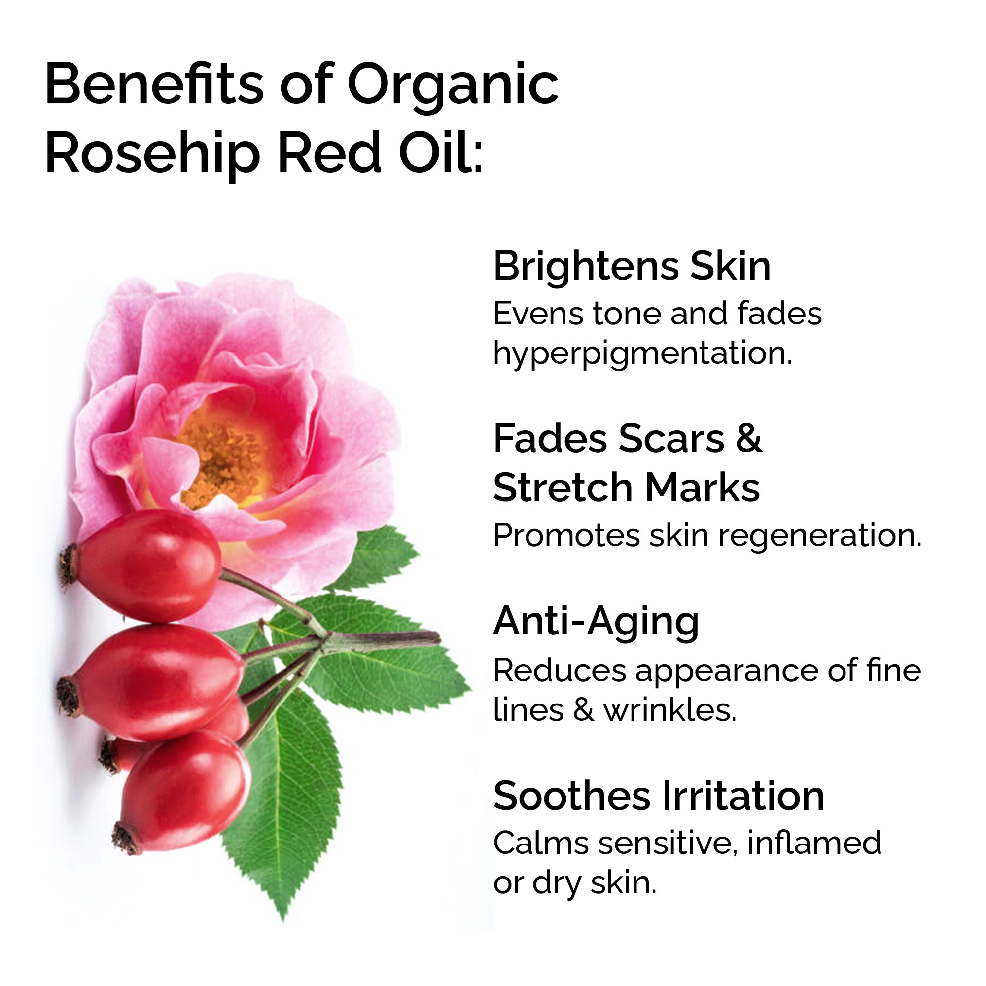 Organic Rosehip Oil – 100% Pure Cold-Pressed Plant-Based Oil for Face, Body &amp; Hair
