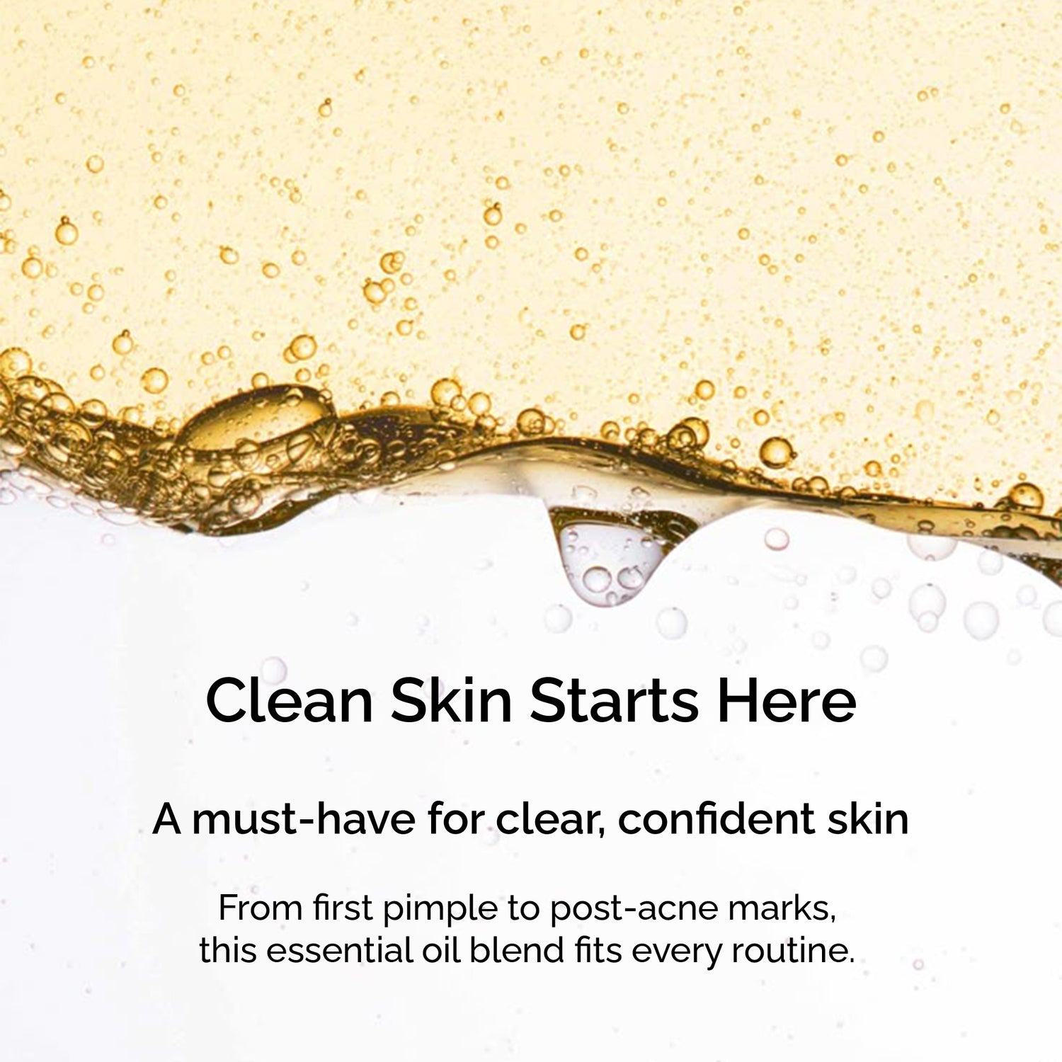 Clear Skin Blend – Essential Oils for Acne, Blemishes &amp; Blackheads