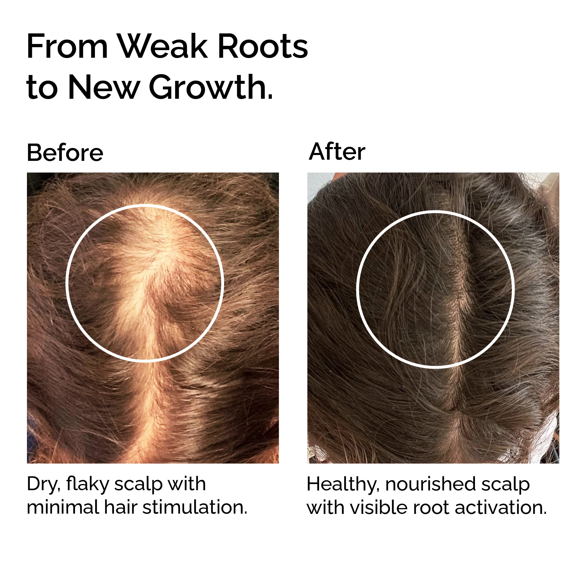 Organic Hair Growth Oil Serum – Strengthening &amp; Nourishing Hair Treatment