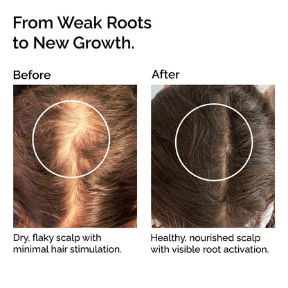 Organic Hair Growth Oil Serum – Strengthening &amp; Nourishing Hair Treatment