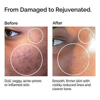 Huile de pépins de courge bio – Huile hydratante naturelle pour les cheveux et la peau