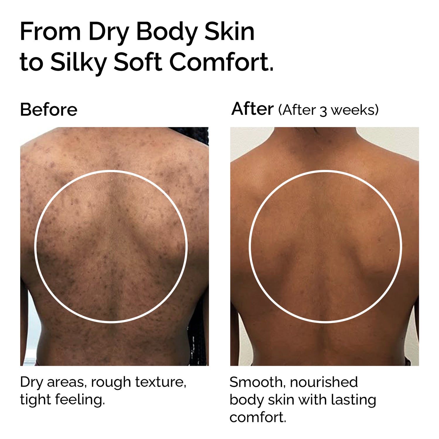 Beurre de Mangue – 100% Pur beurre