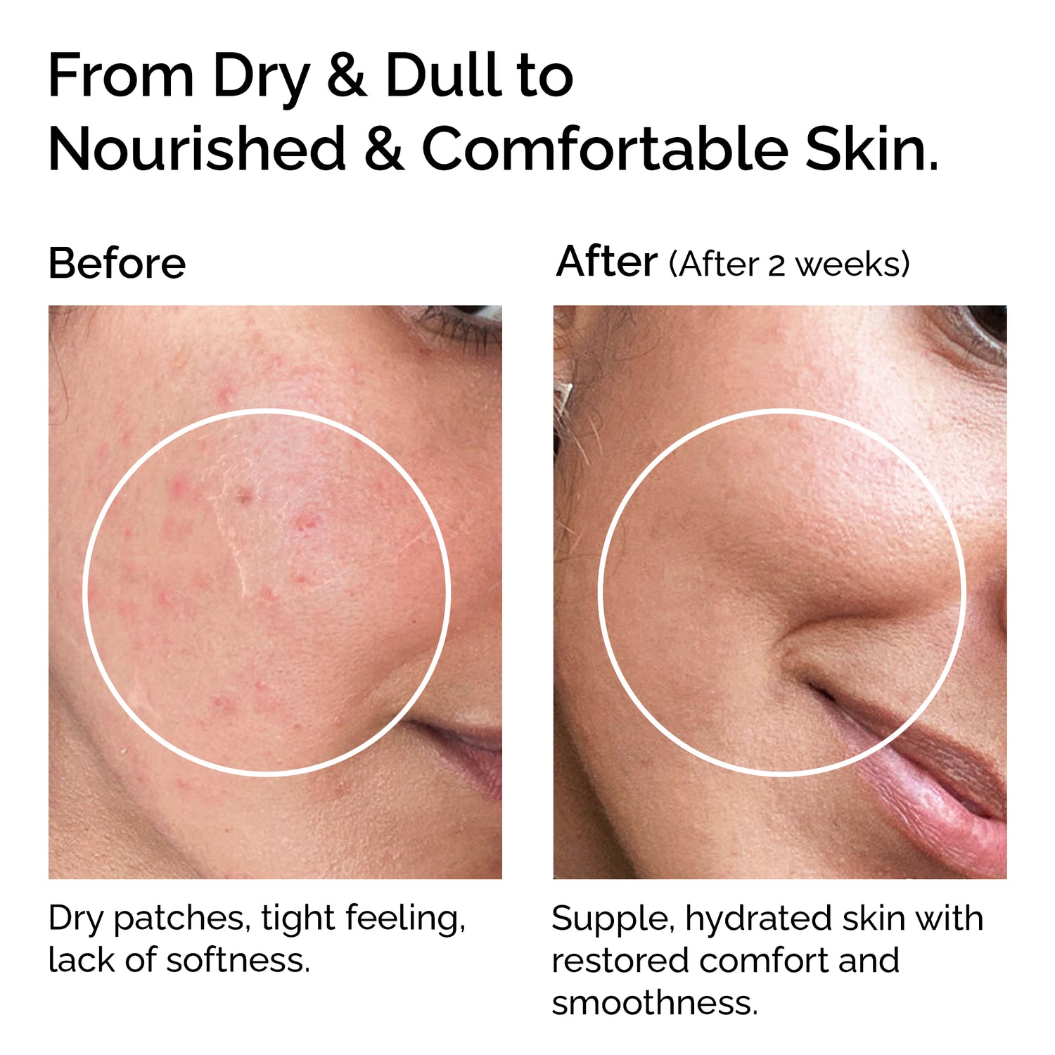 Huile de coco vierge biologique - Pressée à froid pour la peau et les cheveux