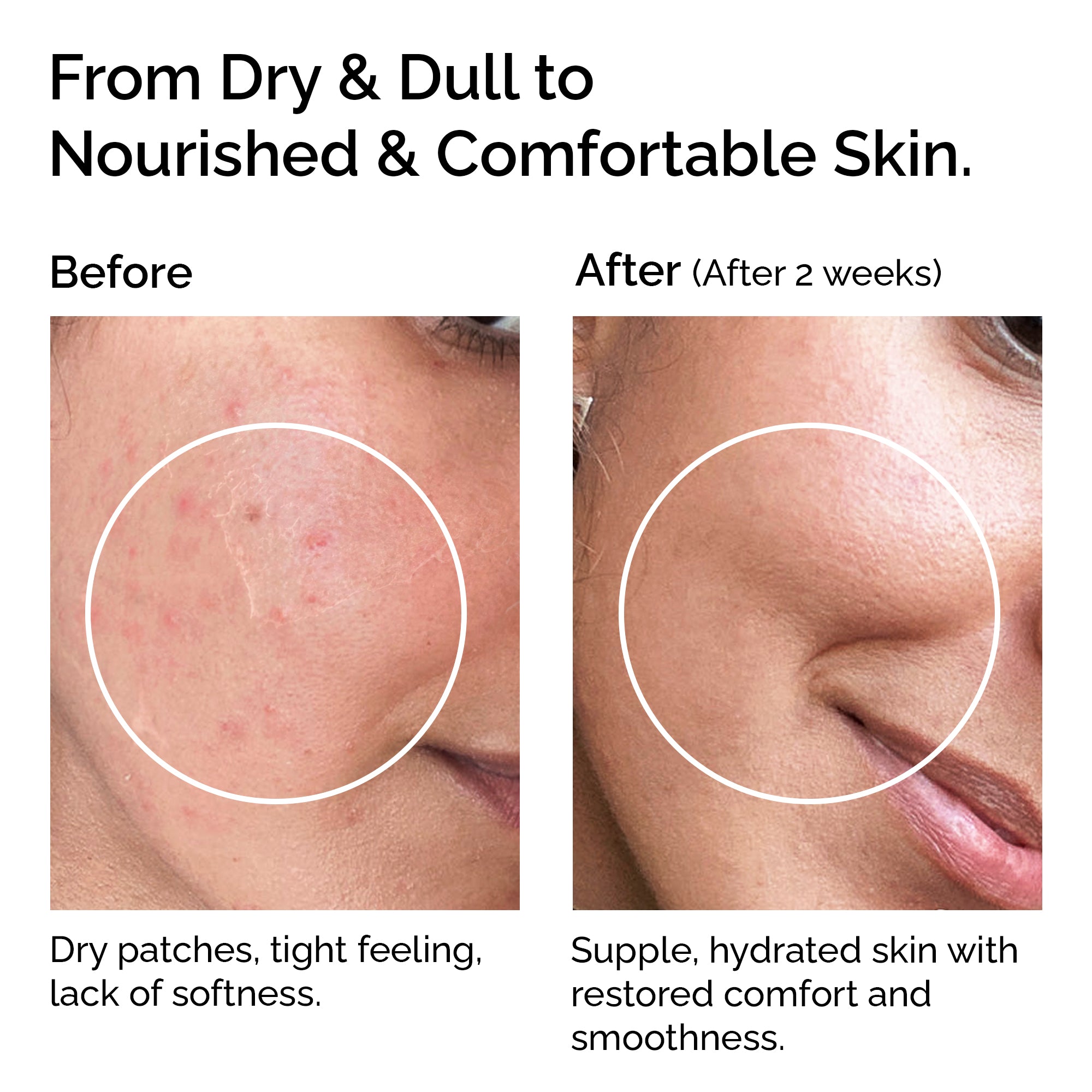 Huile de coco vierge biologique - Pressée à froid pour la peau et les cheveux