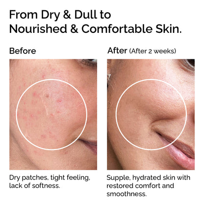 Huile de coco vierge biologique - Pressée à froid pour la peau et les cheveux