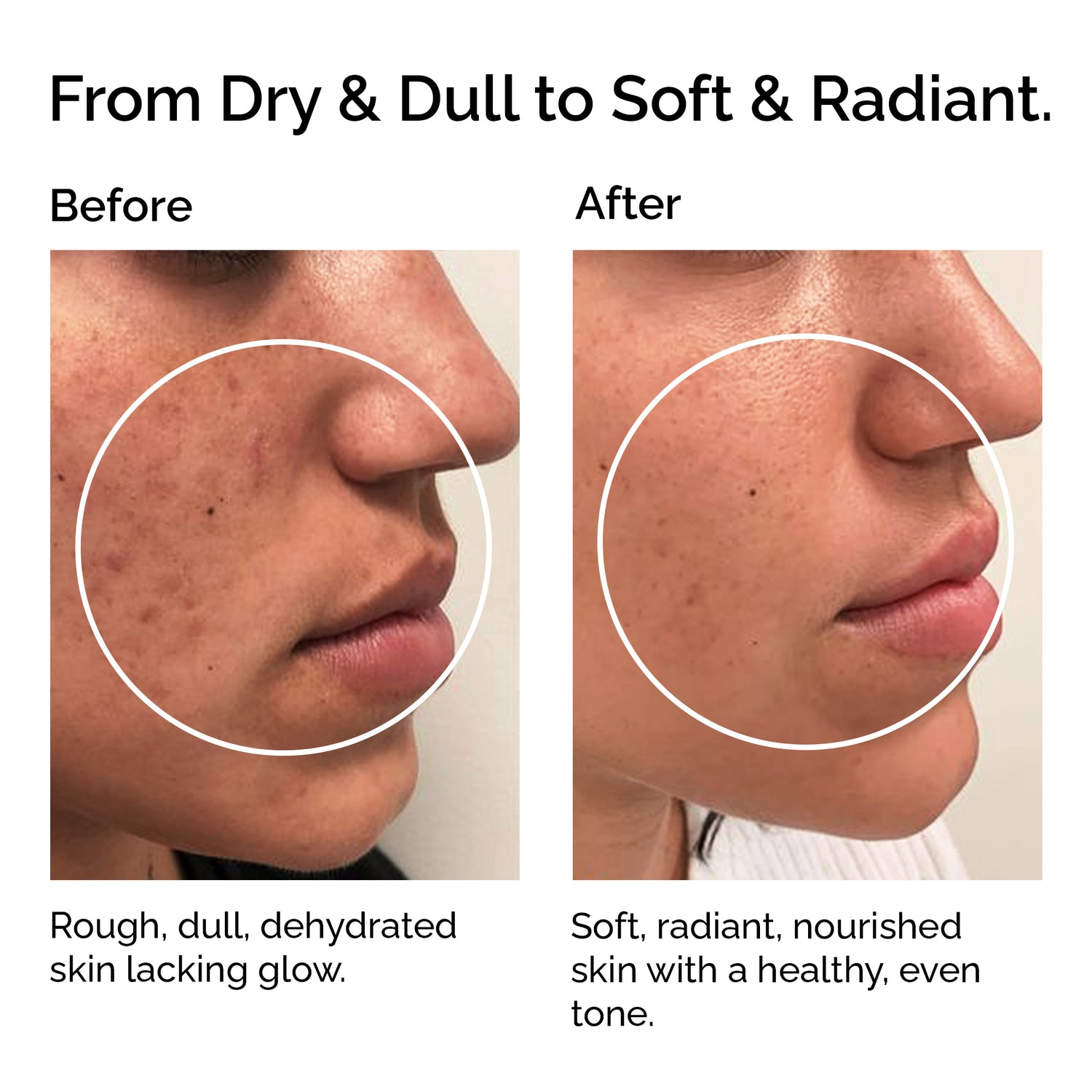 Cold-Pressed Organic Apricot Kernel Oil – Pure Natural Oil for Skin &amp; Hair Care