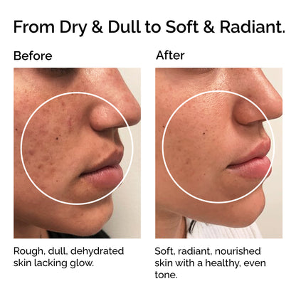 Cold-Pressed Organic Apricot Kernel Oil – Pure Natural Oil for Skin &amp; Hair Care