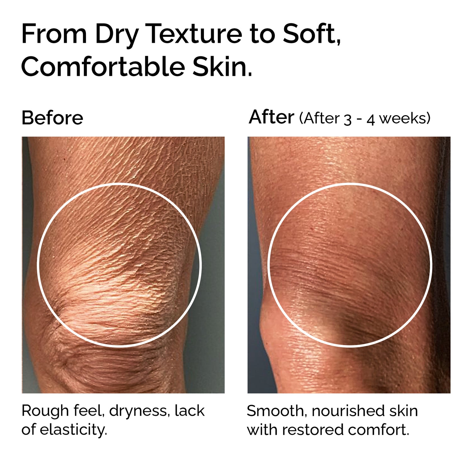 Beurre de Mangue – 100% Pur beurre