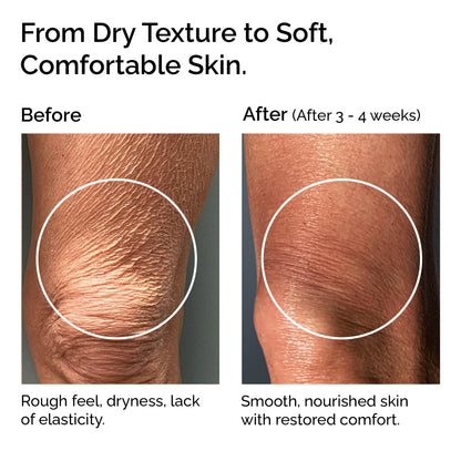 Beurre de Mangue – 100% Pur beurre