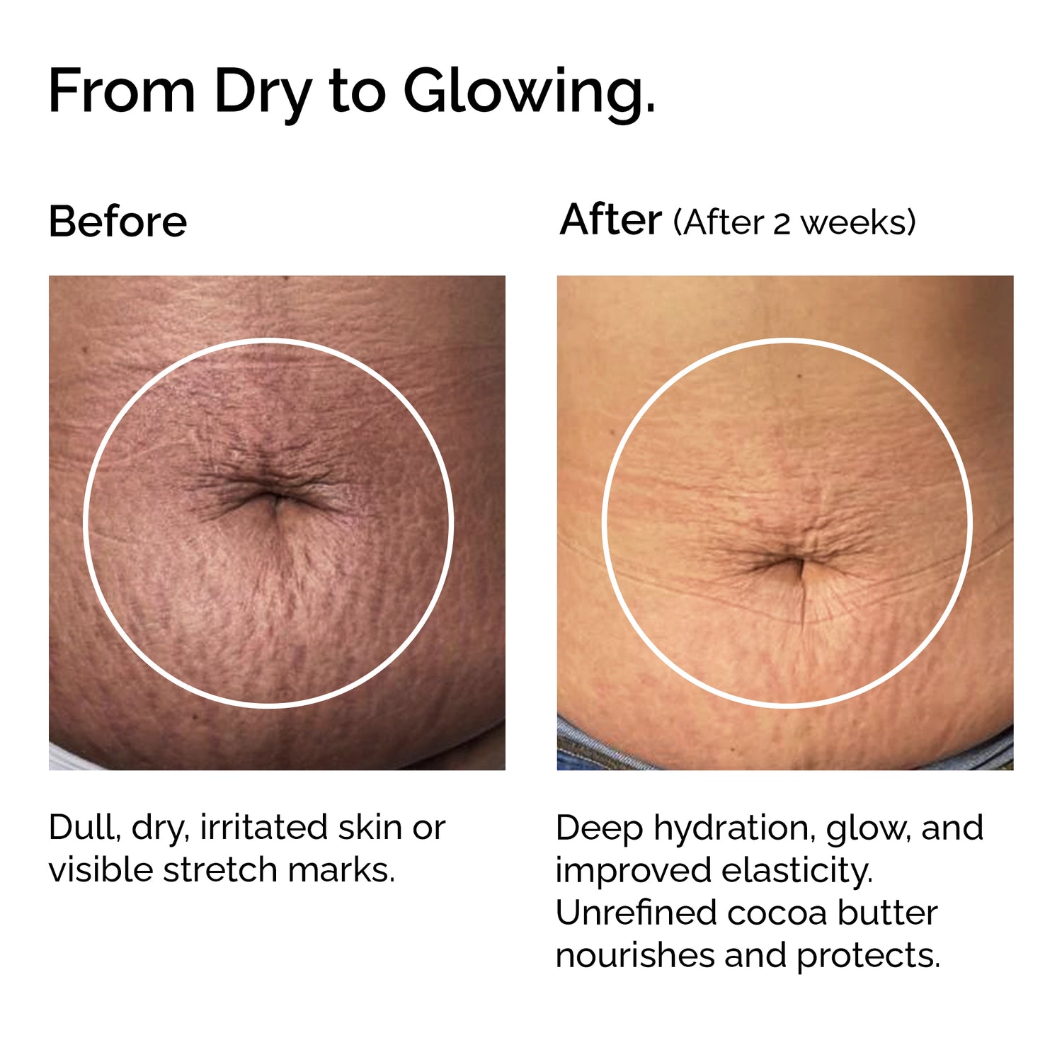 Beurre de cacao 100 % biologique – Formule nourrissante pour la peau et les cheveux