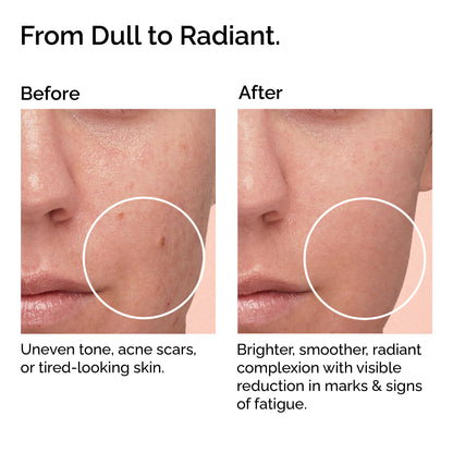 Rosehip Oil – 100% Organic, Cold-Pressed &amp; Pure – Hydrating, Anti-Aging &amp; Scar Care – Fast-Absorbing.