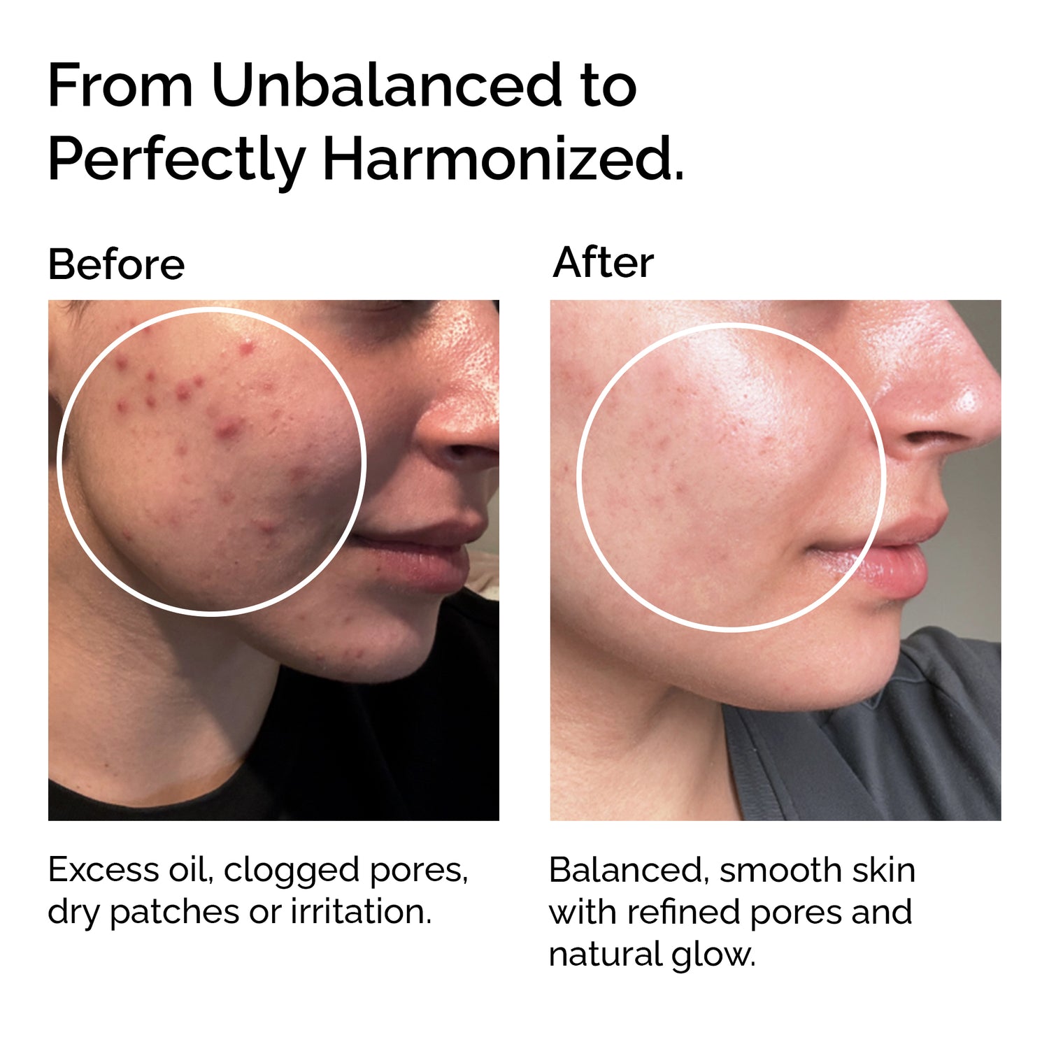 Organic Jojoba Oil – 100% Pure, For Face, Body &amp; Hair Care