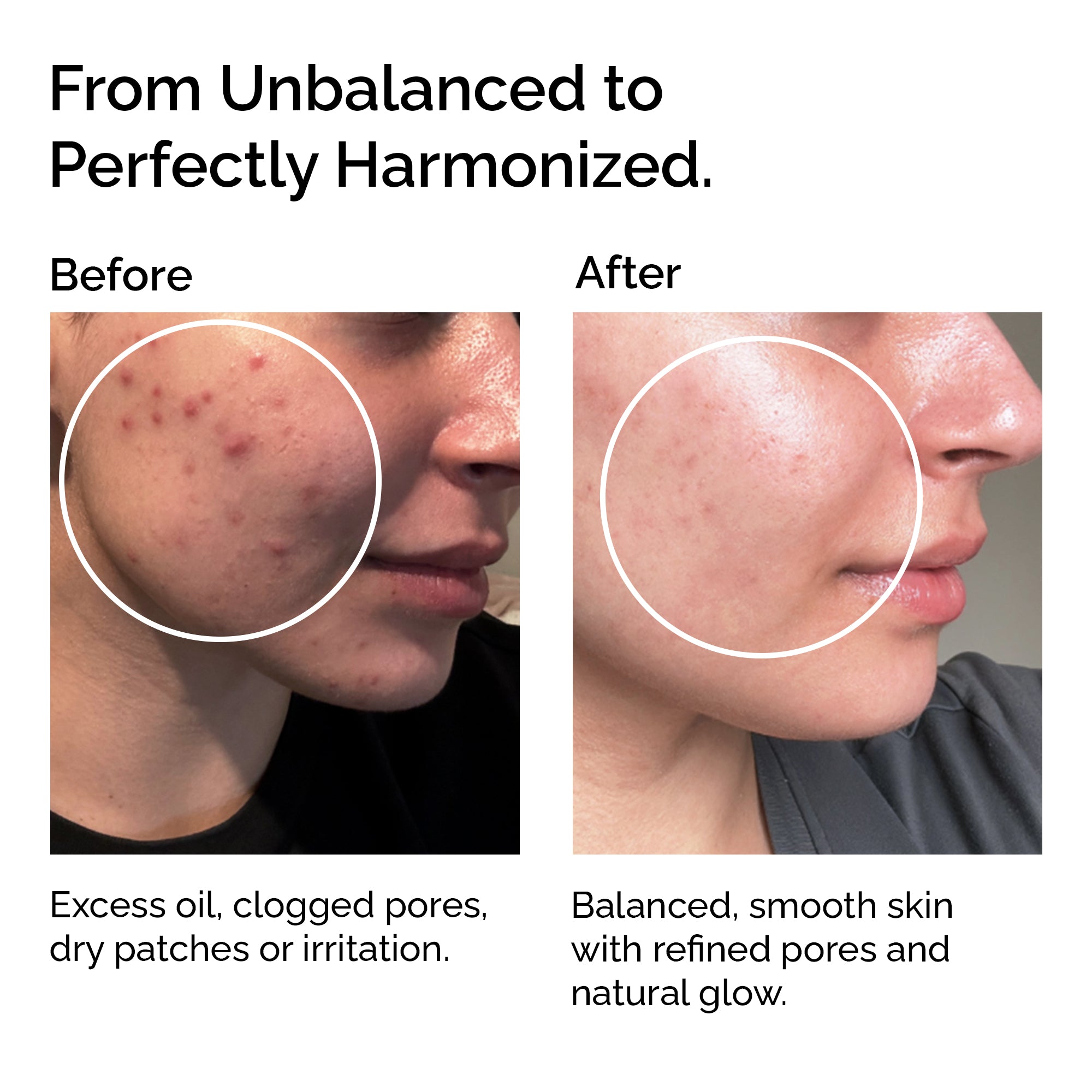 Organic Jojoba Oil – 100% Pure, For Face, Body &amp; Hair Care