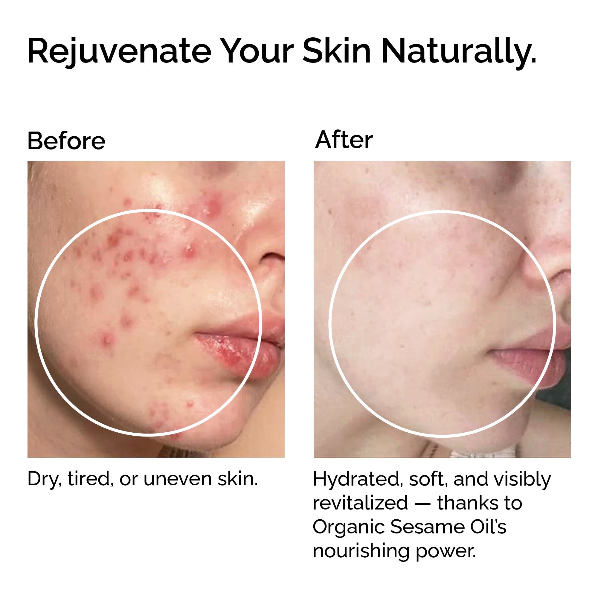 100 % Organic Cold-Pressed Sesame Seed Oil – Skin &amp; Hair Care