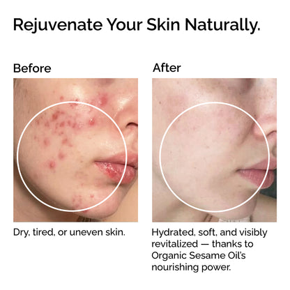 100 % Organic Cold-Pressed Sesame Seed Oil – Skin &amp; Hair Care