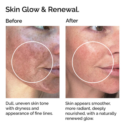 Organic Castor Oil – 100% Pure, Cold-Pressed for Hair, Skin &amp; Lashes