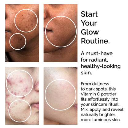 Pure L-Ascorbic Acid (Vitamin C) Powder 30g – For Face, Skin, Body &amp; Hair Brightening Care