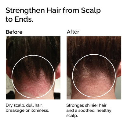 Organic Jojoba Oil – 100% Pure, For Face, Body &amp; Hair Care