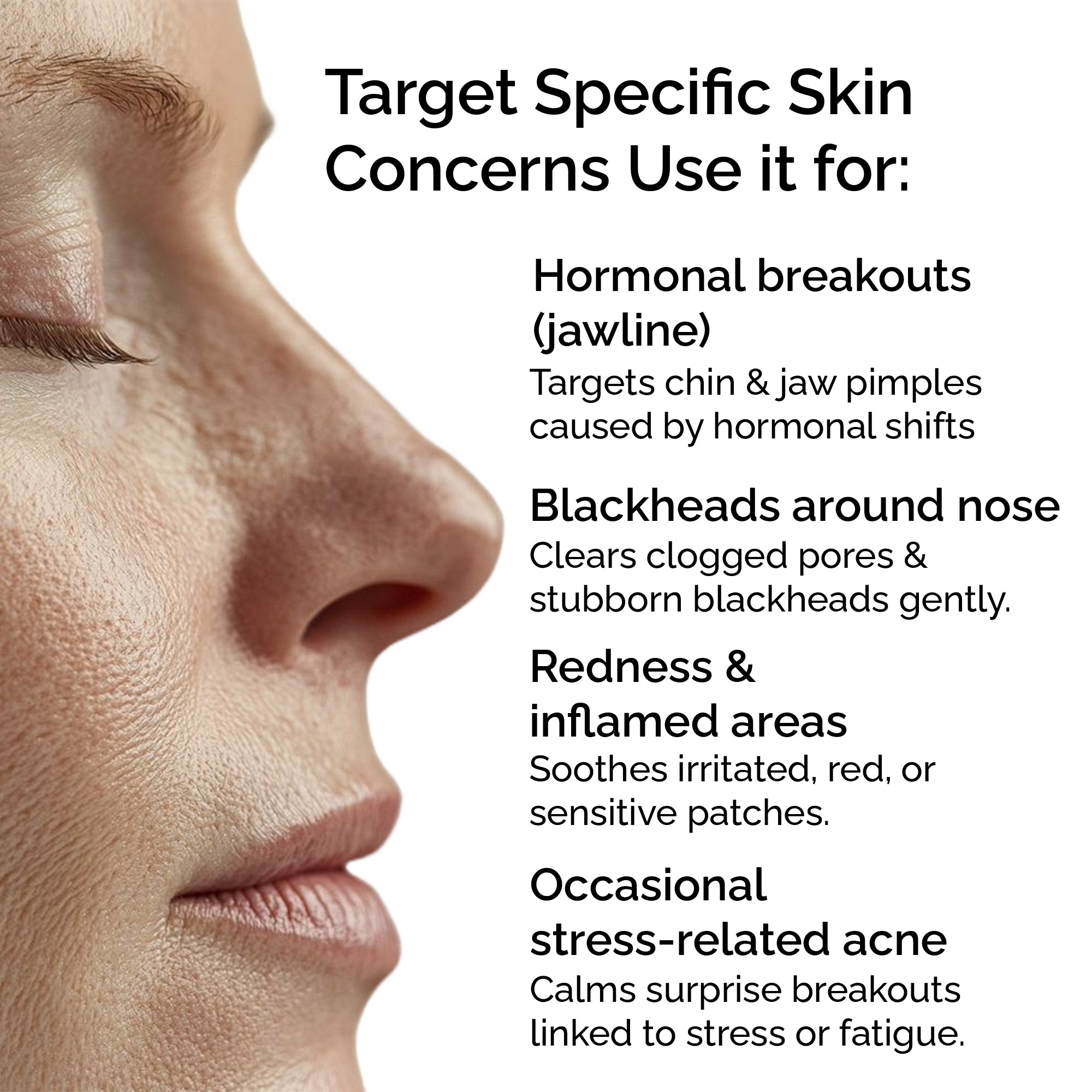 Clear Skin Blend – Essential Oils for Acne, Blemishes &amp; Blackheads