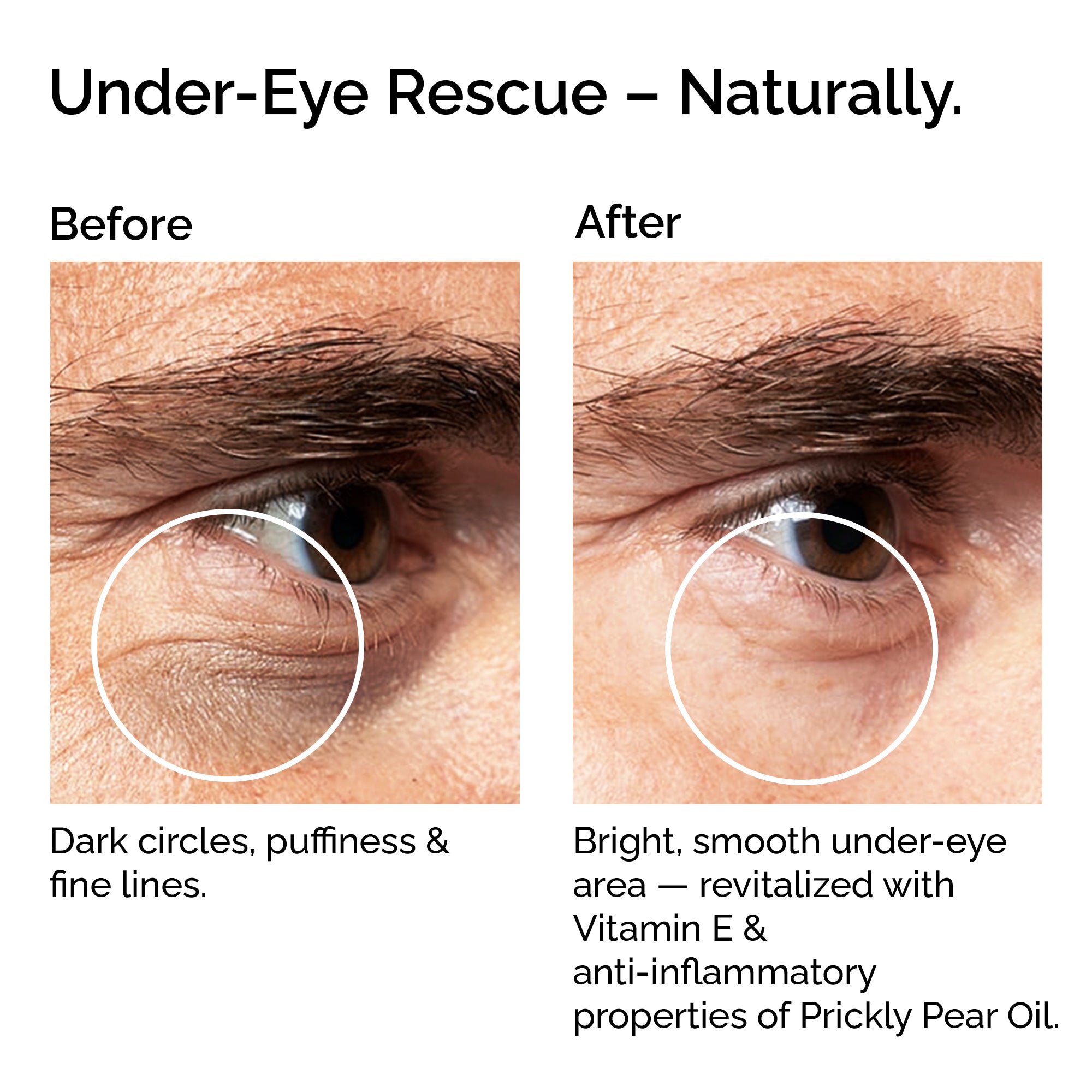 Before and after comparison of under-eye area with dark circles, puffiness, and fine lines treated with a natural remedy.